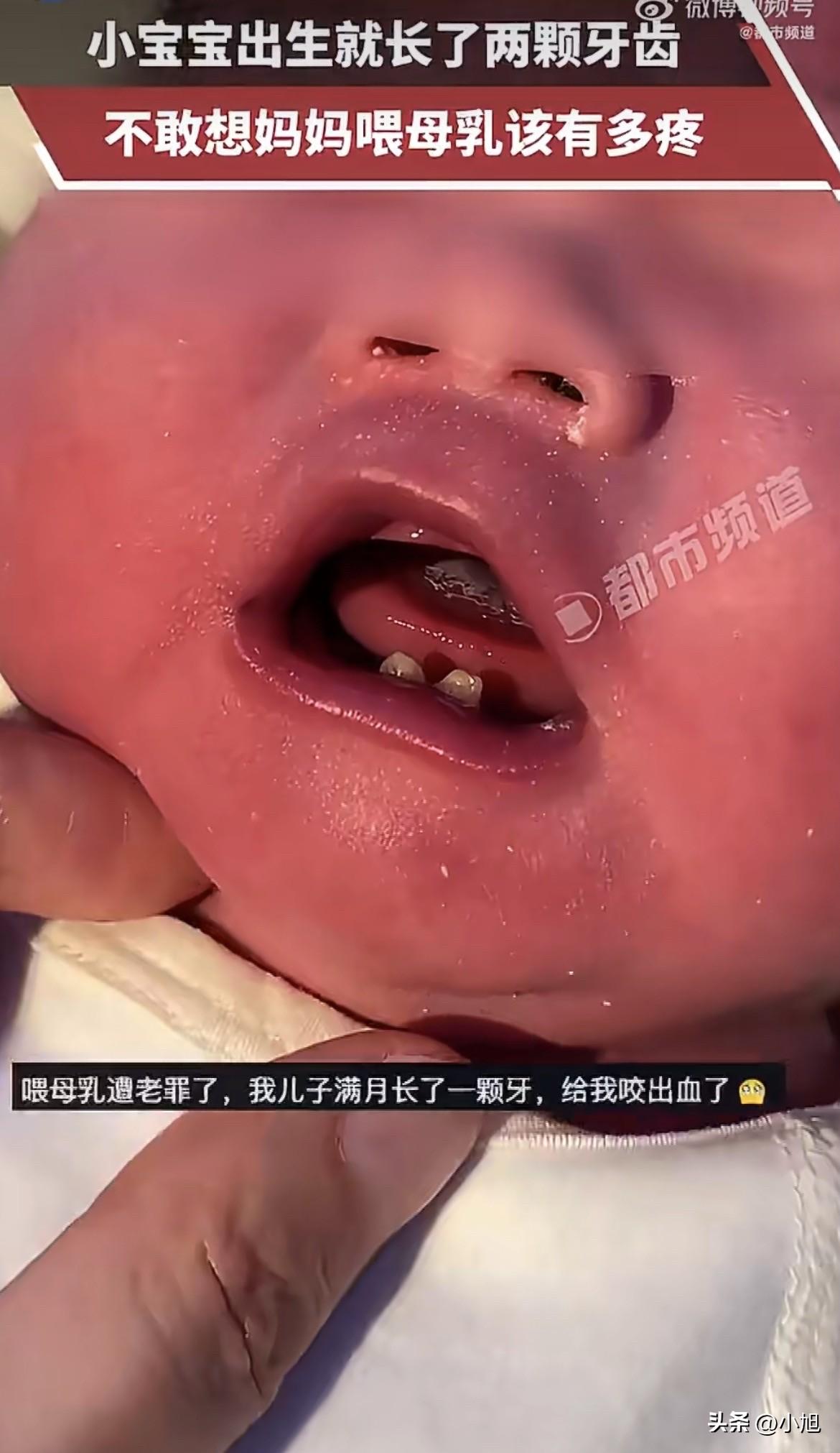 刚落地的小不点，张嘴一哭，好家伙，下牙床明晃晃长着两颗牙！这事儿一下就把我好奇心