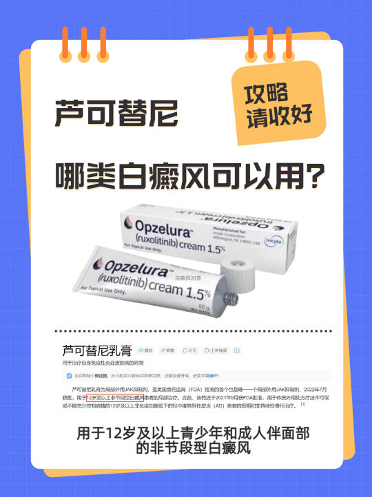 芦可替尼哪类白癜风类型可以用？用错了吗❓