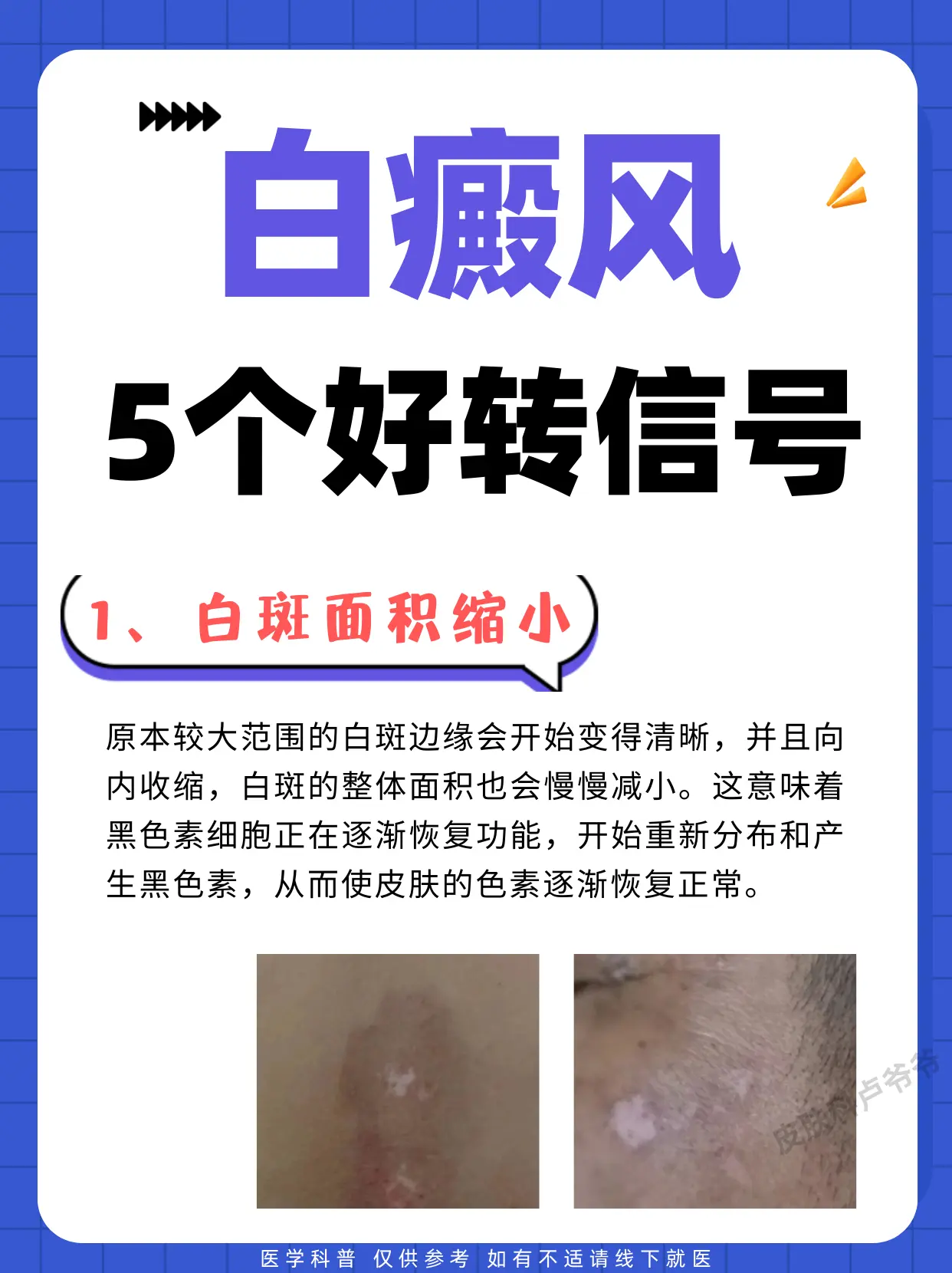医学科普 白癜风 白斑 硬核健康科普行动 医疗健康训练营
