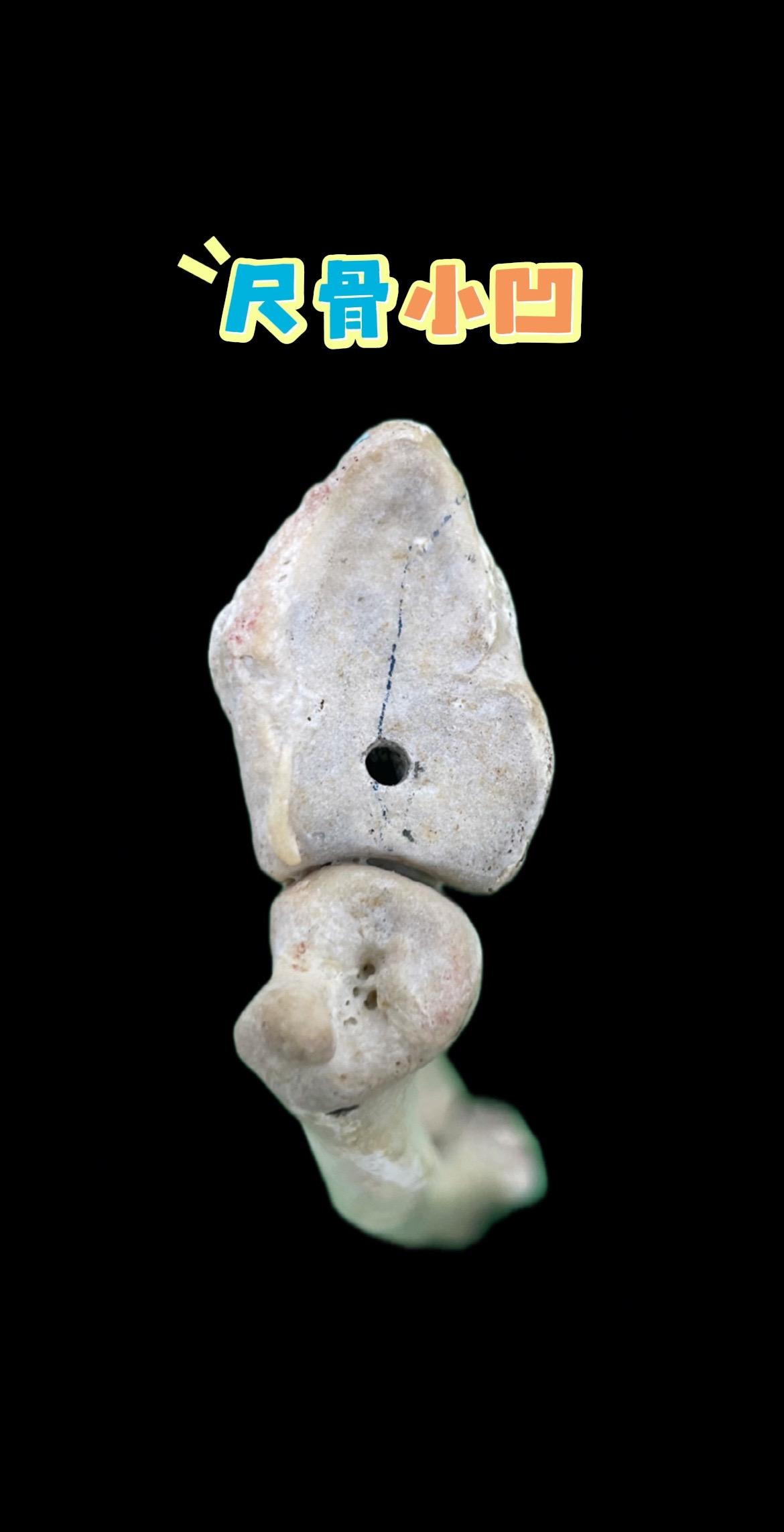 尺骨小凹。腕关节疼？大概率和这个部位有关！尺骨小凹——肌腱密集附着+T...