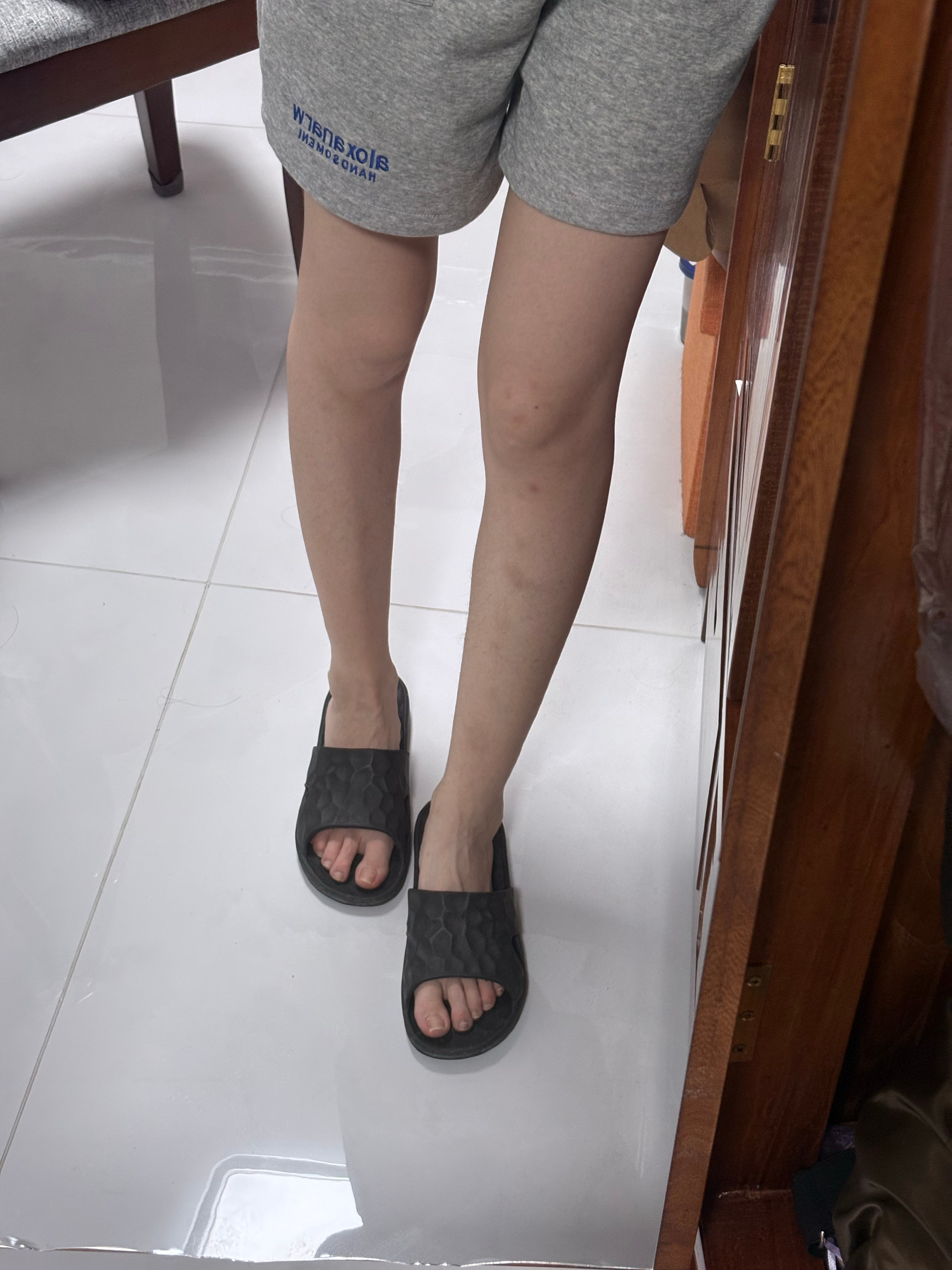 我的腿最近： 