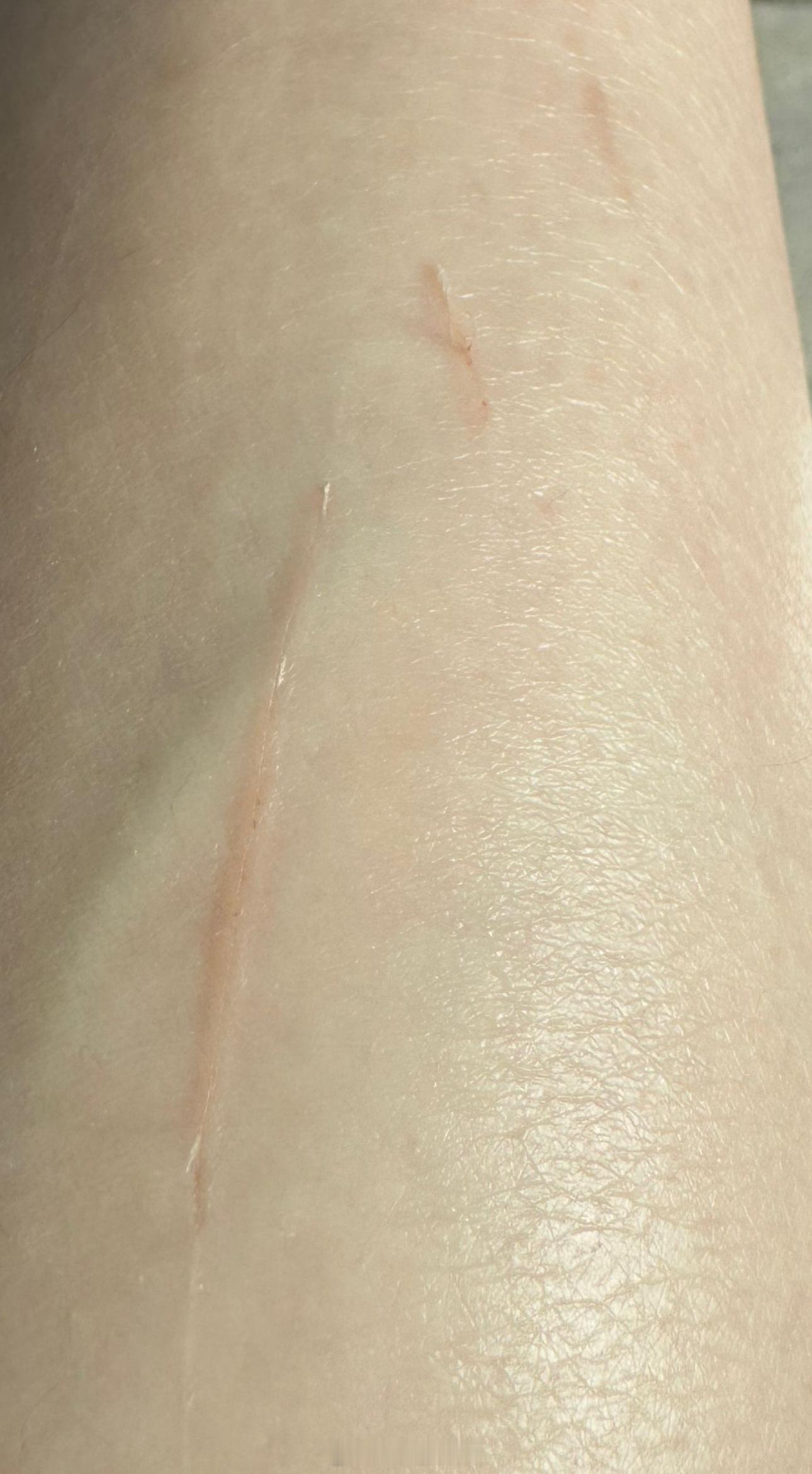我服了，我坐在🚽上拉💩呢小猴靠过来突然当我猫爬架一样，抱着我的腿开始练爪我穿