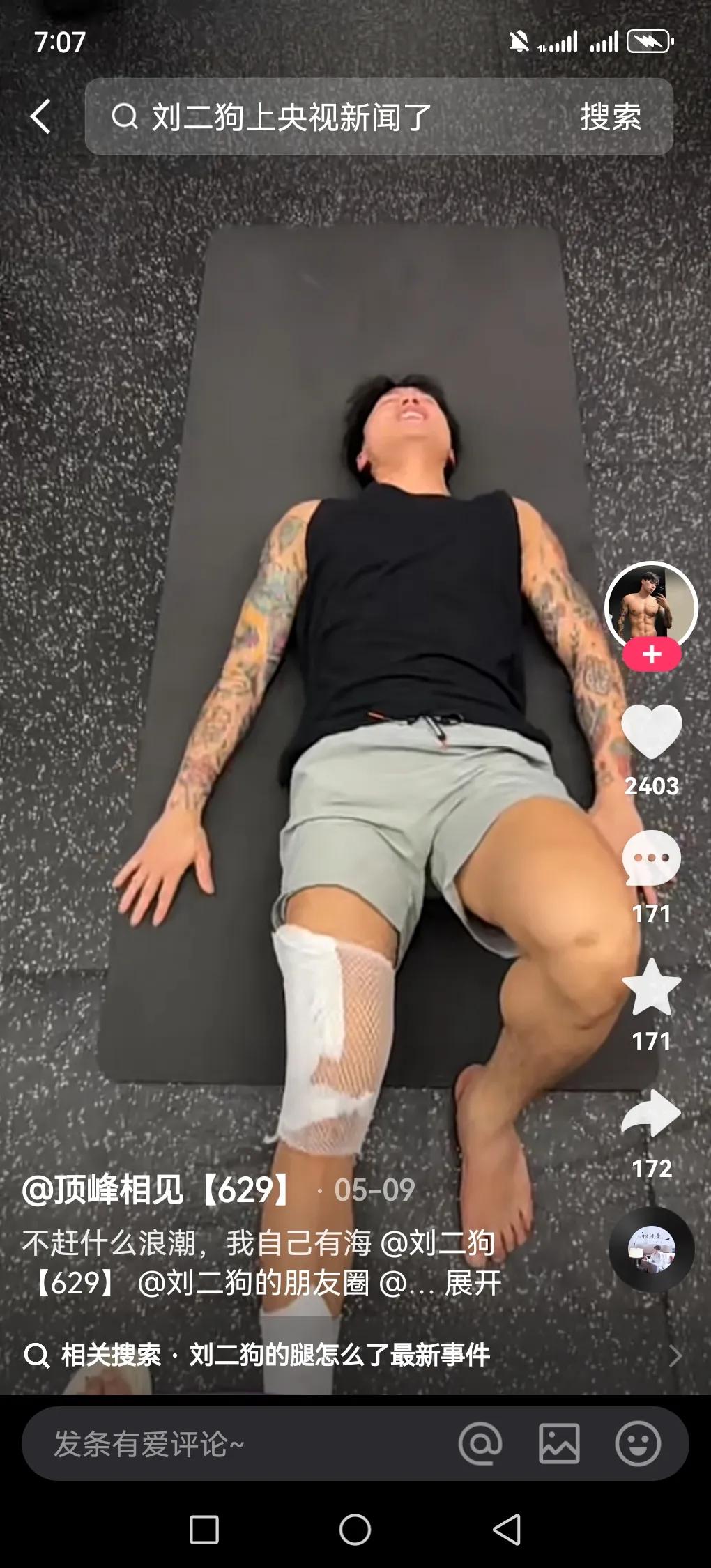 网红刘二狗打球腿受伤这事儿，让我想起他之前那些风波。之前快手深夜露骨直播暴走那次