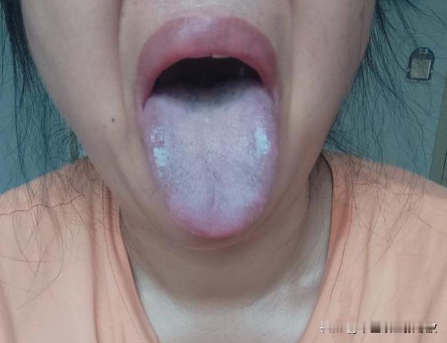 人说，10病9拖，这姐姐就是非常典型的案例[给力][给力][给力]
门诊大姐，3
