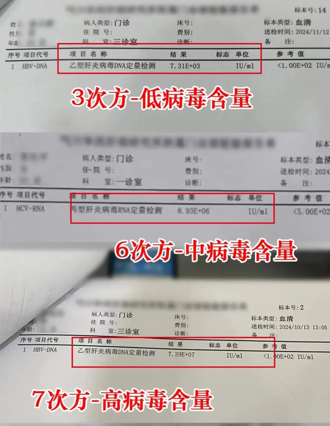 乙肝病毒DNA定量检测值通常以科学计数法表示，例如“1.23E+03”...