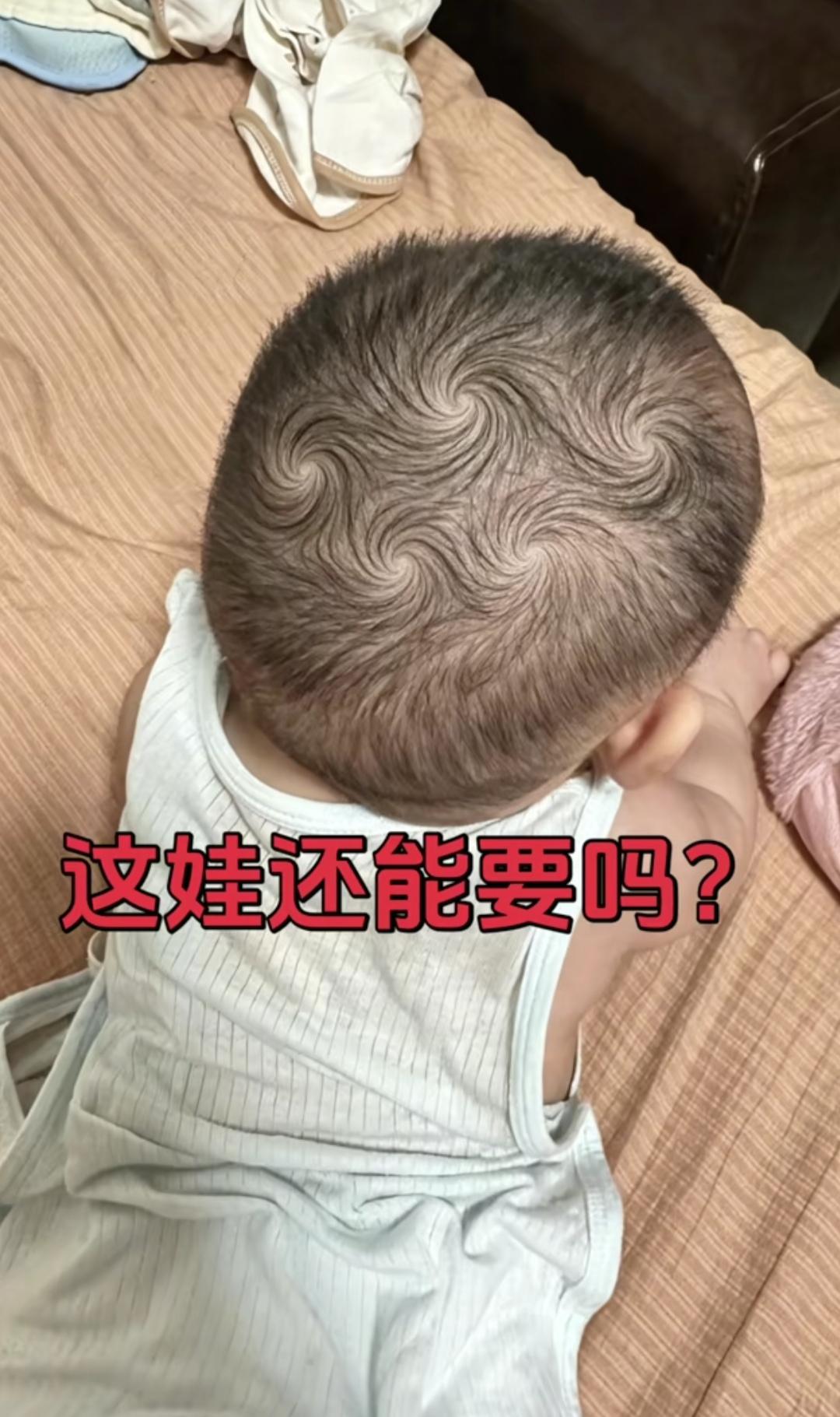 女子生了一个娃娃，头上居然有五个旋。女子之前从未见过，他想问问大家：5个旋是什么