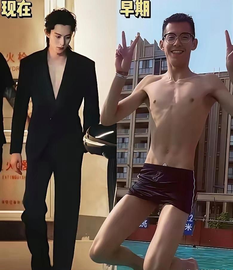 王鹤棣早期vs现在 