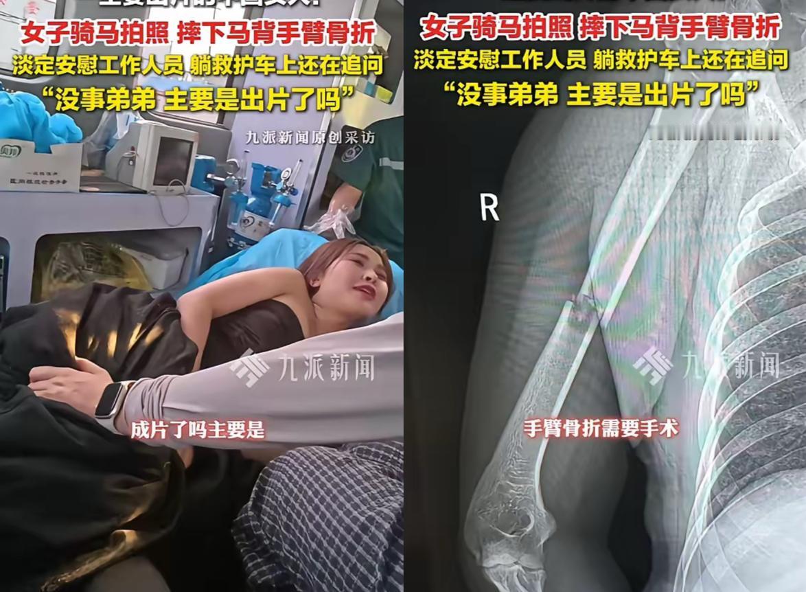 山东临沂一名女子为拍摄“策马奔腾”的飒爽画面首次骑马，不料马匹突然变向致其摔落骨