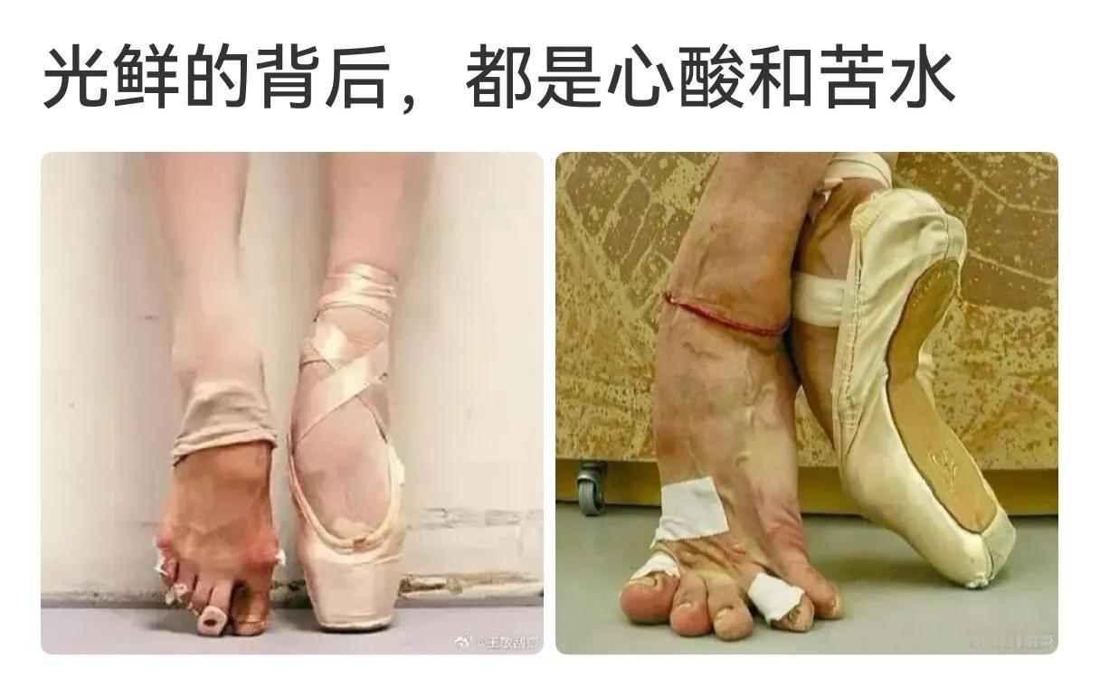 这种“舞蹈”是西方宫廷变态“舞蹈”，对身体的摧残不亚于妇女缠足！