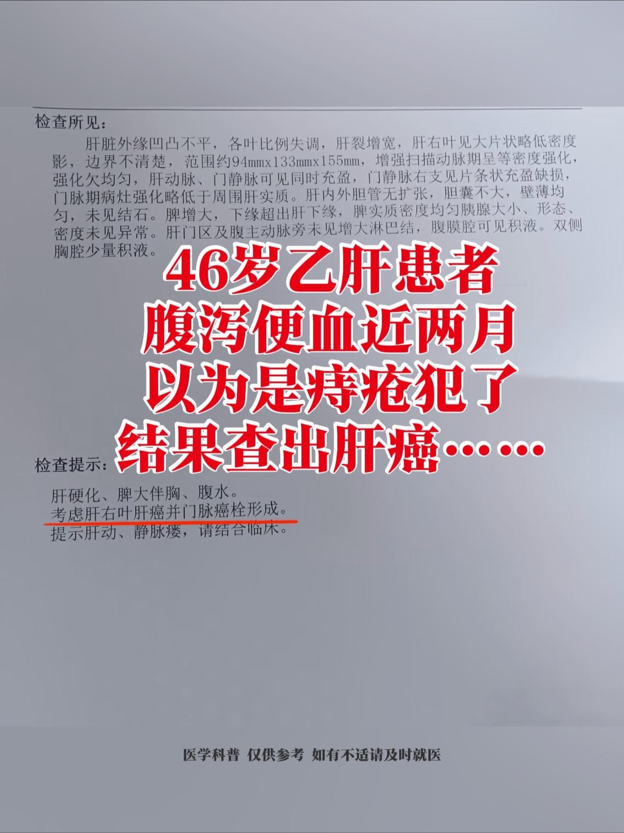 前几天接诊的一个患者确诊了肝癌，今年才46岁，以前有乙肝，但是没治过...