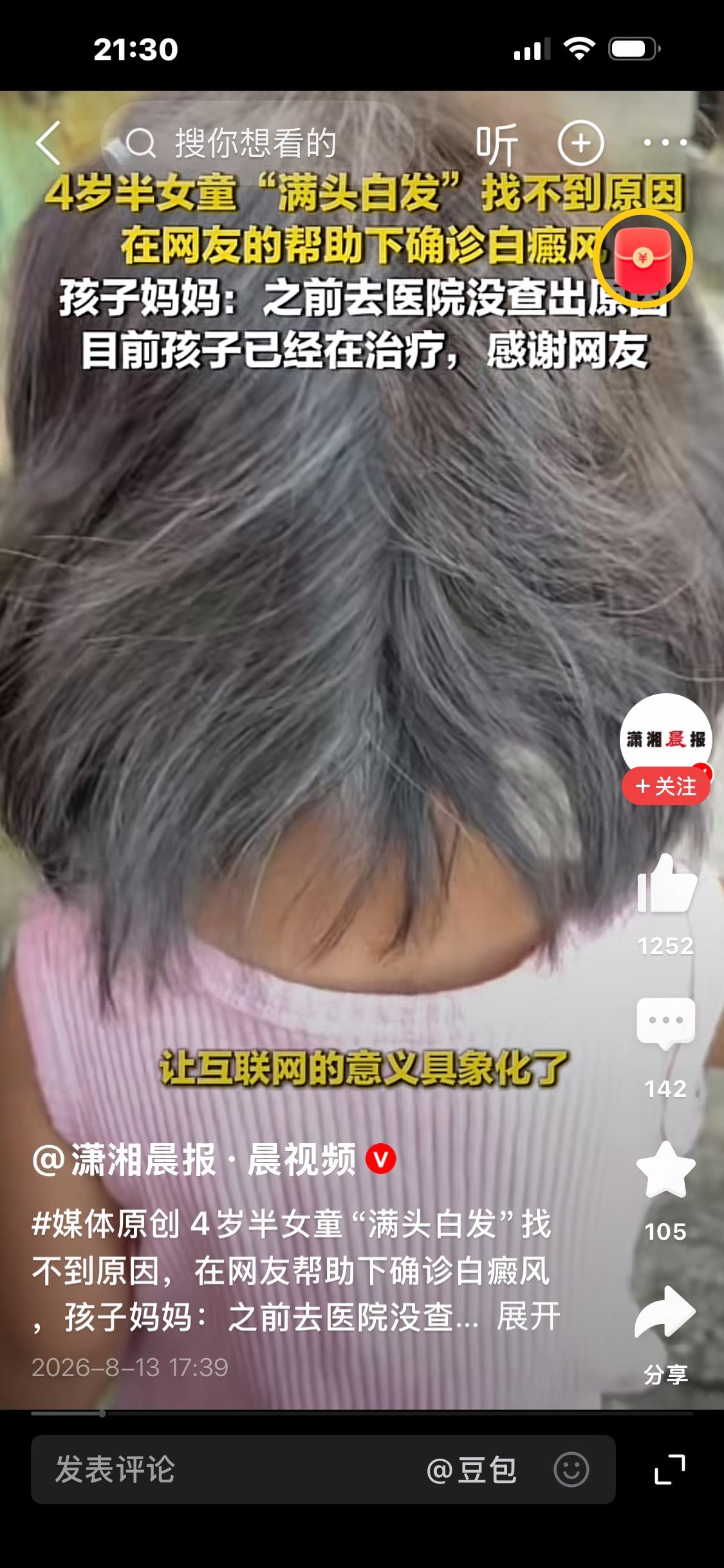 4岁半女童半年长出满头白发，多次检查找不到病因！网友支招后确诊白癜风

贵州毕节
