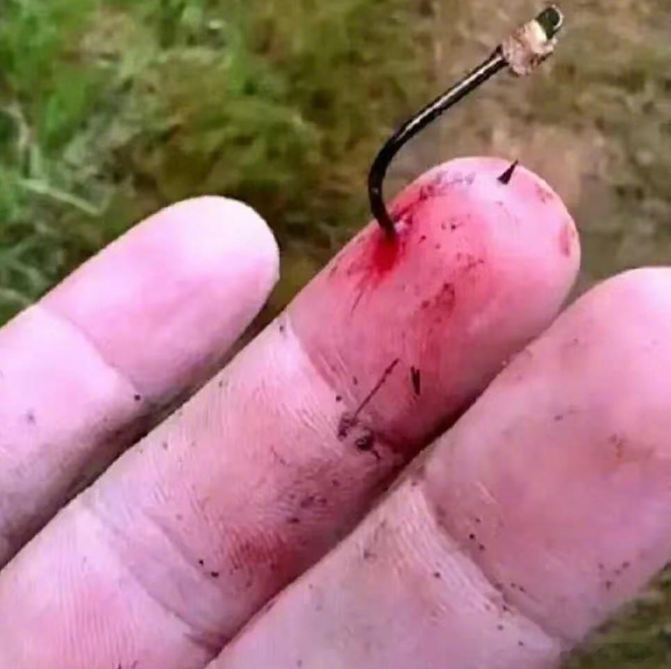 我经常可以见到被鱼钩钩住的人，从钩住手脚、嘴巴到钩住丁丁都有。没有倒刺的鱼钩，钩
