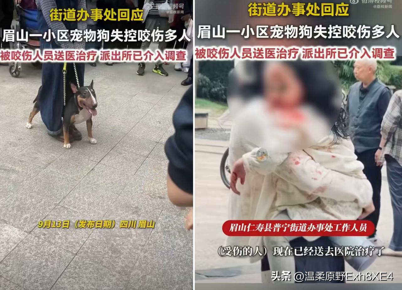 狗咬人，不只“赔钱了事”！四川眉山县，女童遭恶犬咬伤面部，狗主人被刑拘。

这事