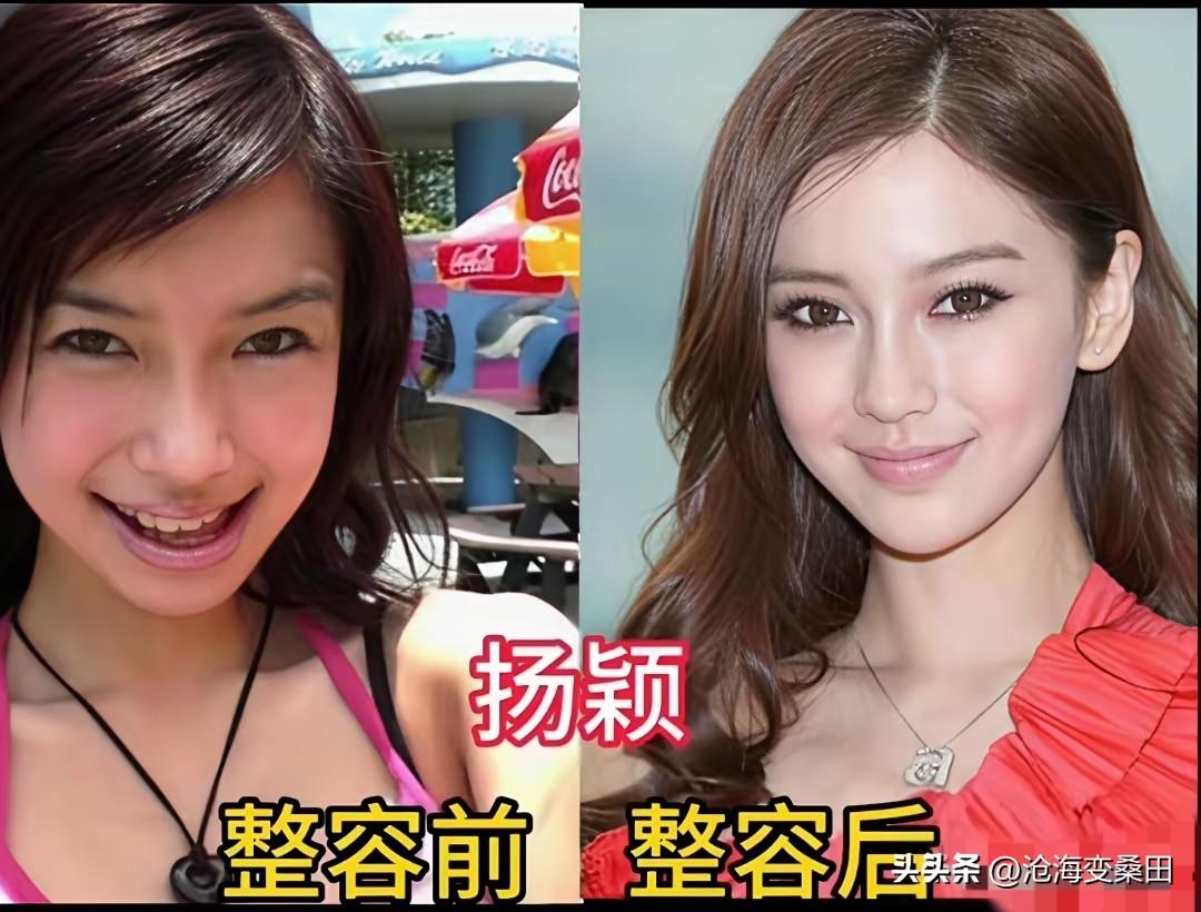 这些女明星微调后更好看了，五官更端正立体，果然有钱就是好呀
