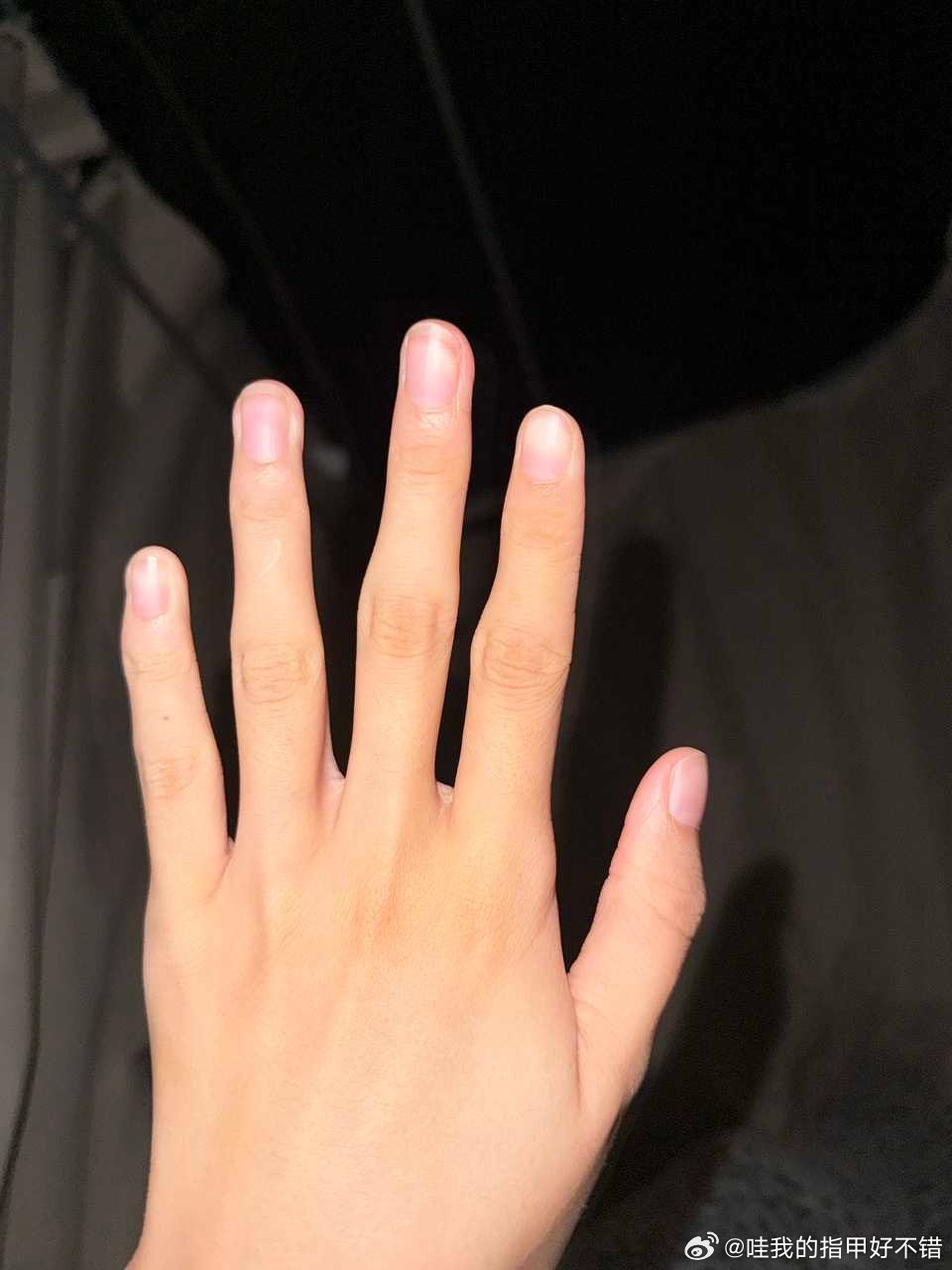 【💅🏻34252】想问问我这种手适合什么甲型呀手指非常弯曲骨节非常突出 