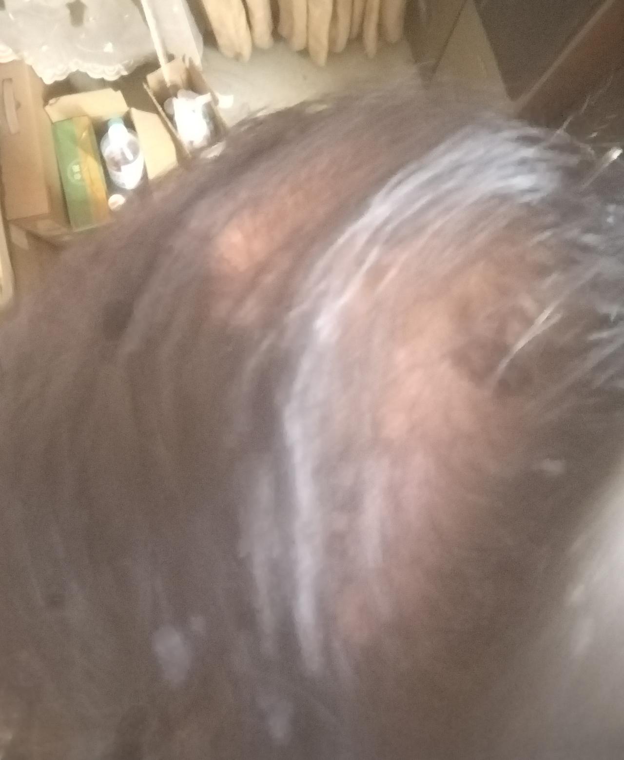 你在照片中看到了什么？是胎记、掉发、毫针，还是年龄或者健康状况？我们可不能觉得看