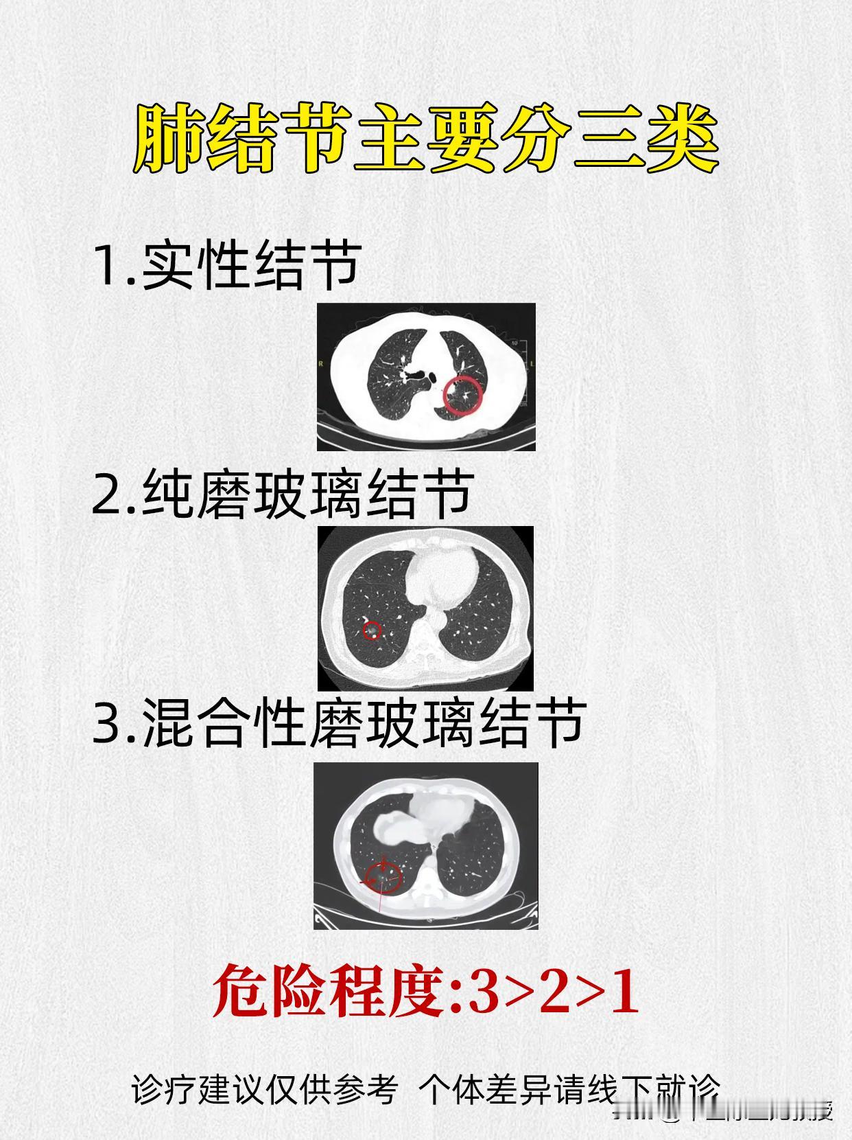 肺结节主要分三类，这些危险程度，要谨记！
肺结节[超话]结节呼吸肺病