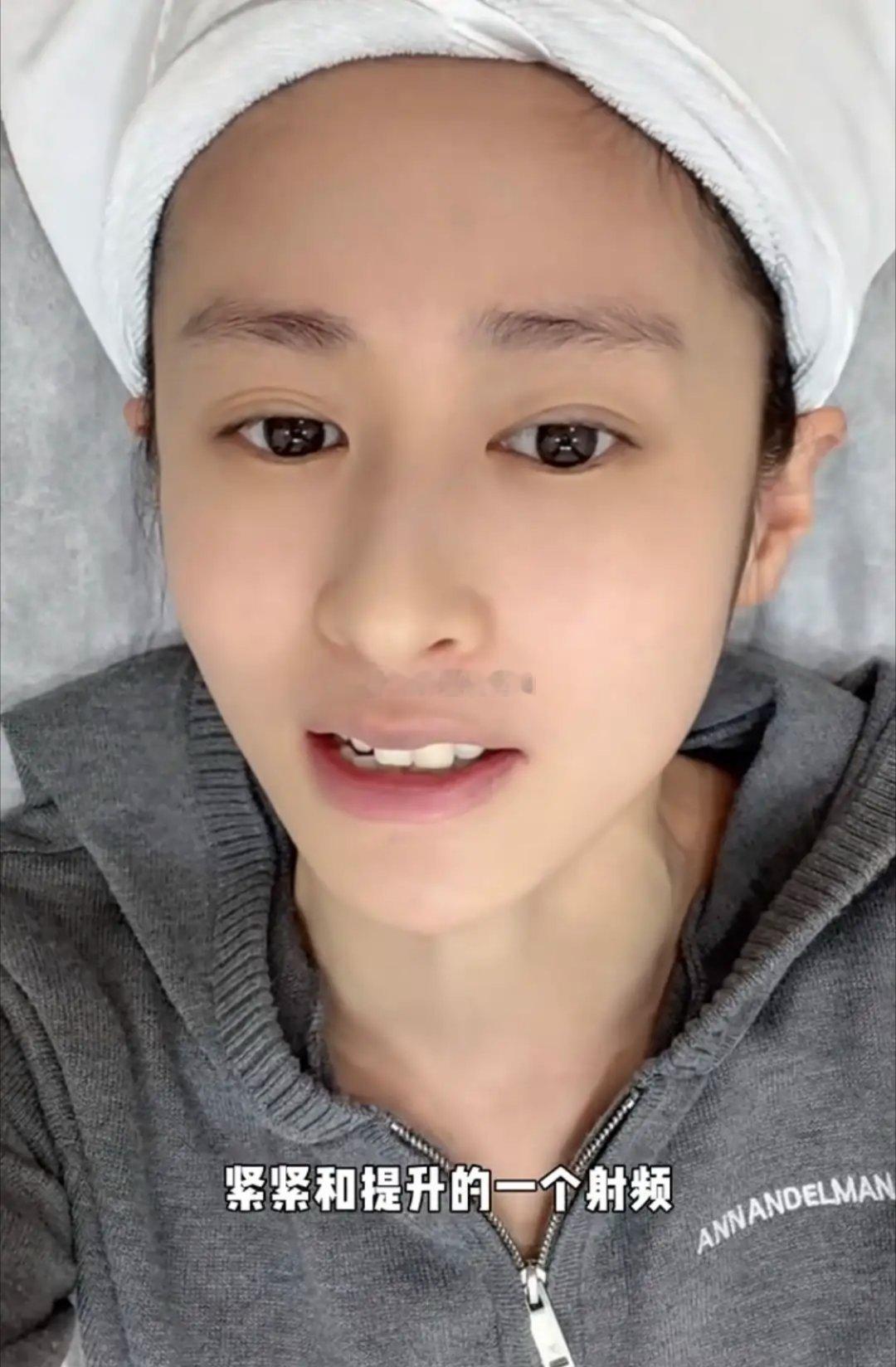 付辛博老婆做眼部热玛吉，37岁颖儿嘴有点歪了，敷完麻药还是疼哭！！！！！ 