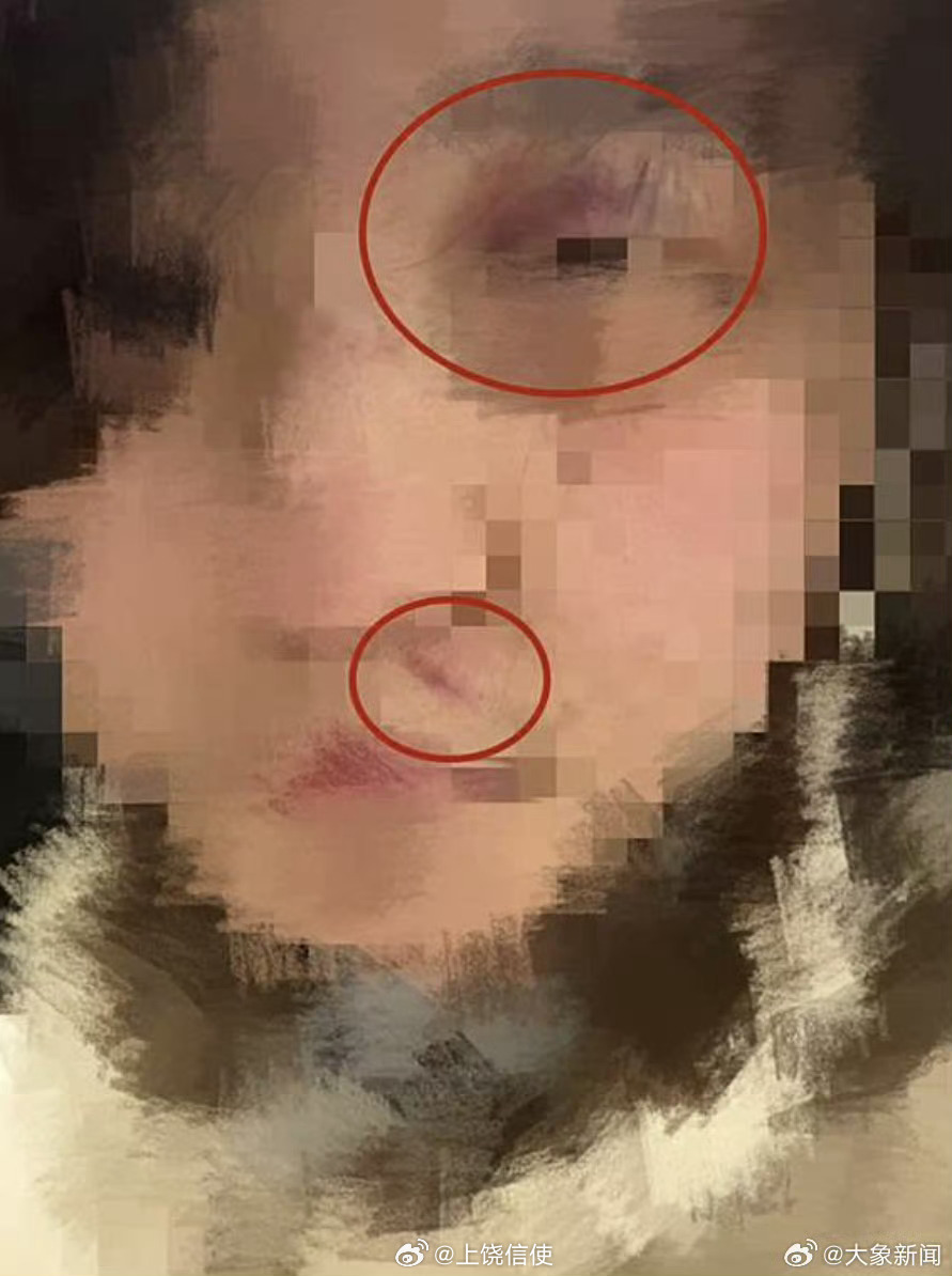 【17岁女生讲述被多次殴打性侵细节：对方疑有暴力倾向】警方回应男大学生殴打女生案