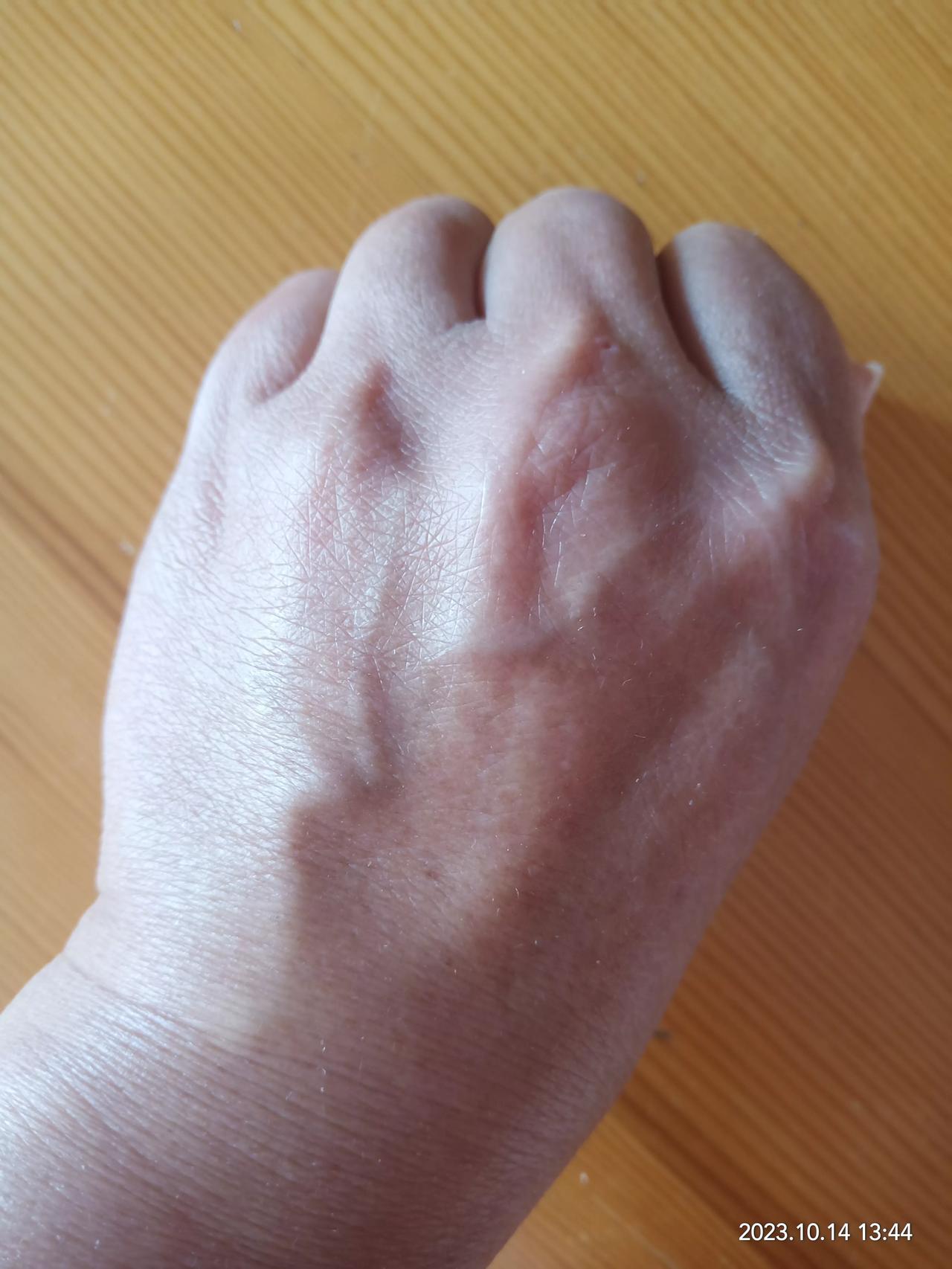看看图上这双女人的手，真正的皮包骨，青筋暴起，长满老年斑，十个指甲颜色苍白，并且