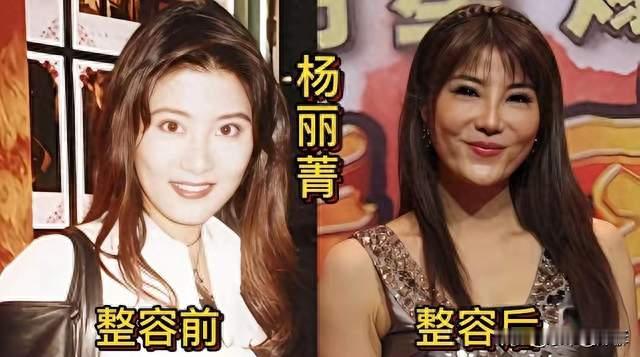 整容早己是中性词了！大大方方的承认有啥错