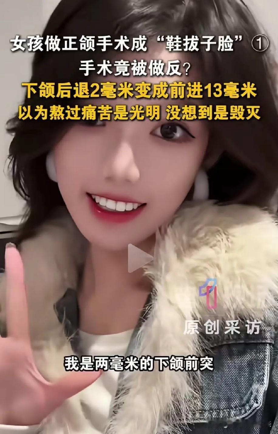 太离谱了！武汉，24岁女模特牙齿有个小问题去看牙，医生把她下颌骨方向切反了，脸直