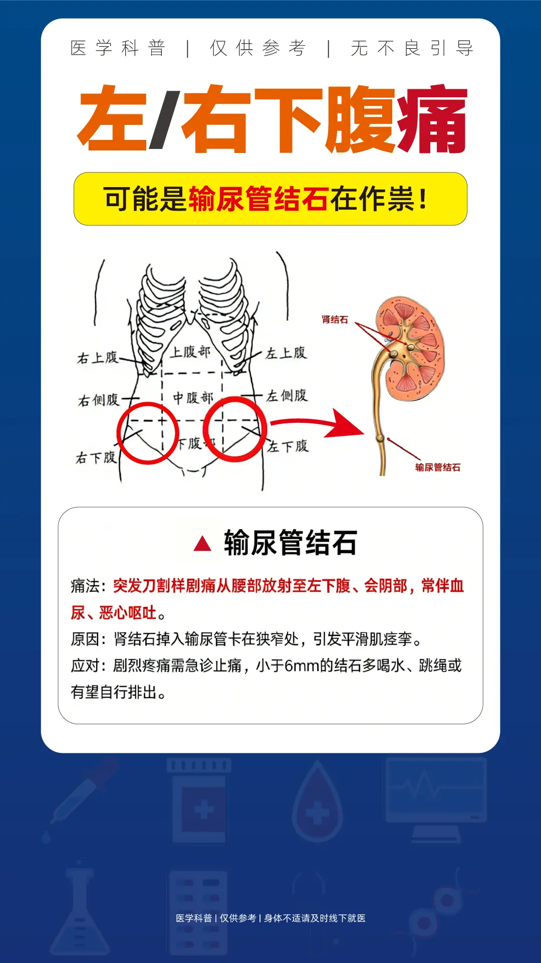 左下腹和右下腹剧痛？可能输尿管结石在作祟。