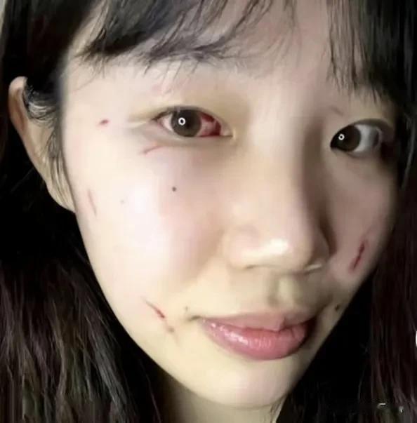 让人心疼，最接中国女篮联赛一场比赛引起争议，就是北京首钢女篮与福建厦门女篮的比赛