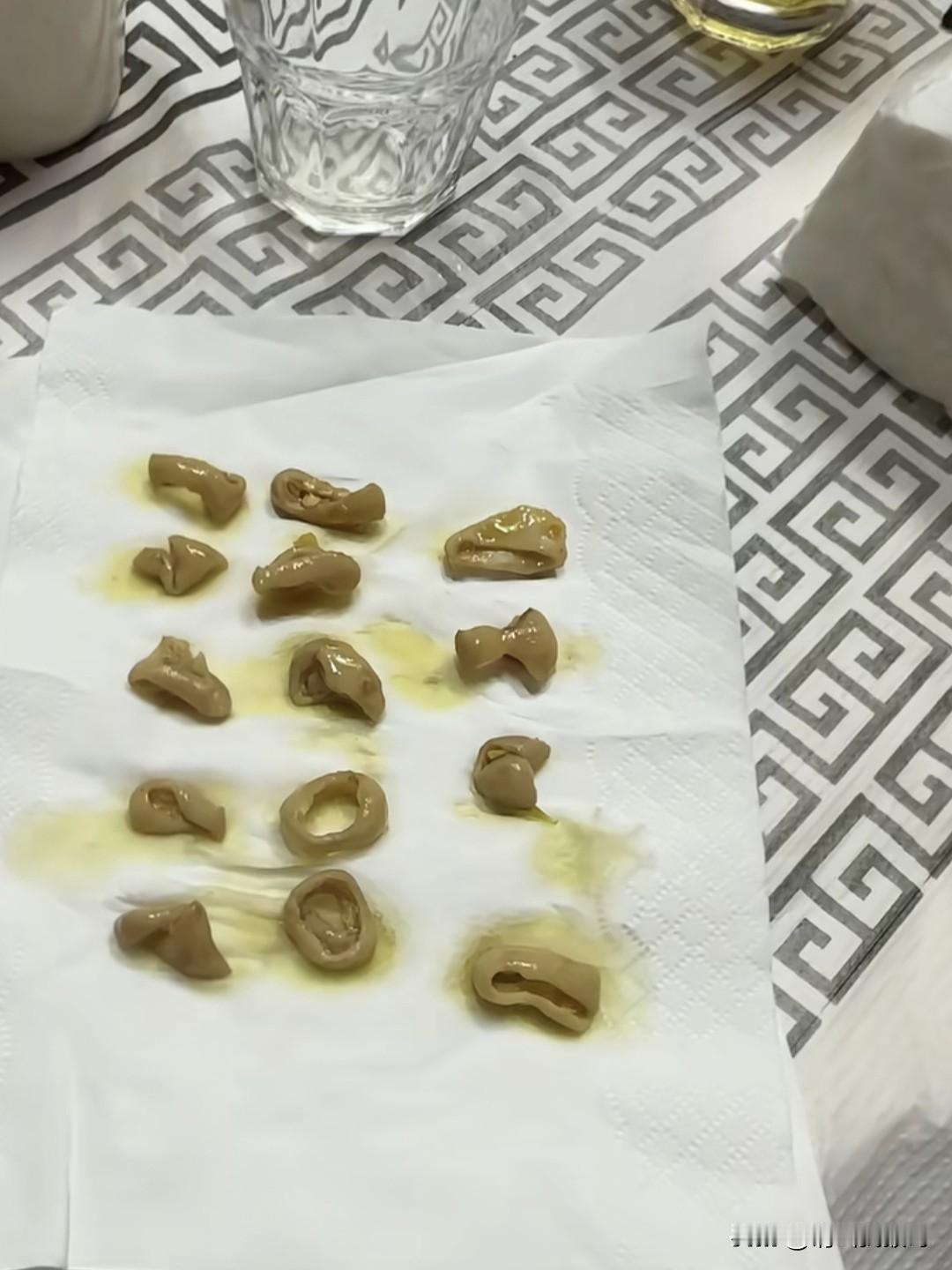 一网友发视频称，在外面跟朋友吃饭，其中有一碗“酸菜肥肠”，里面只有可怜的15小段