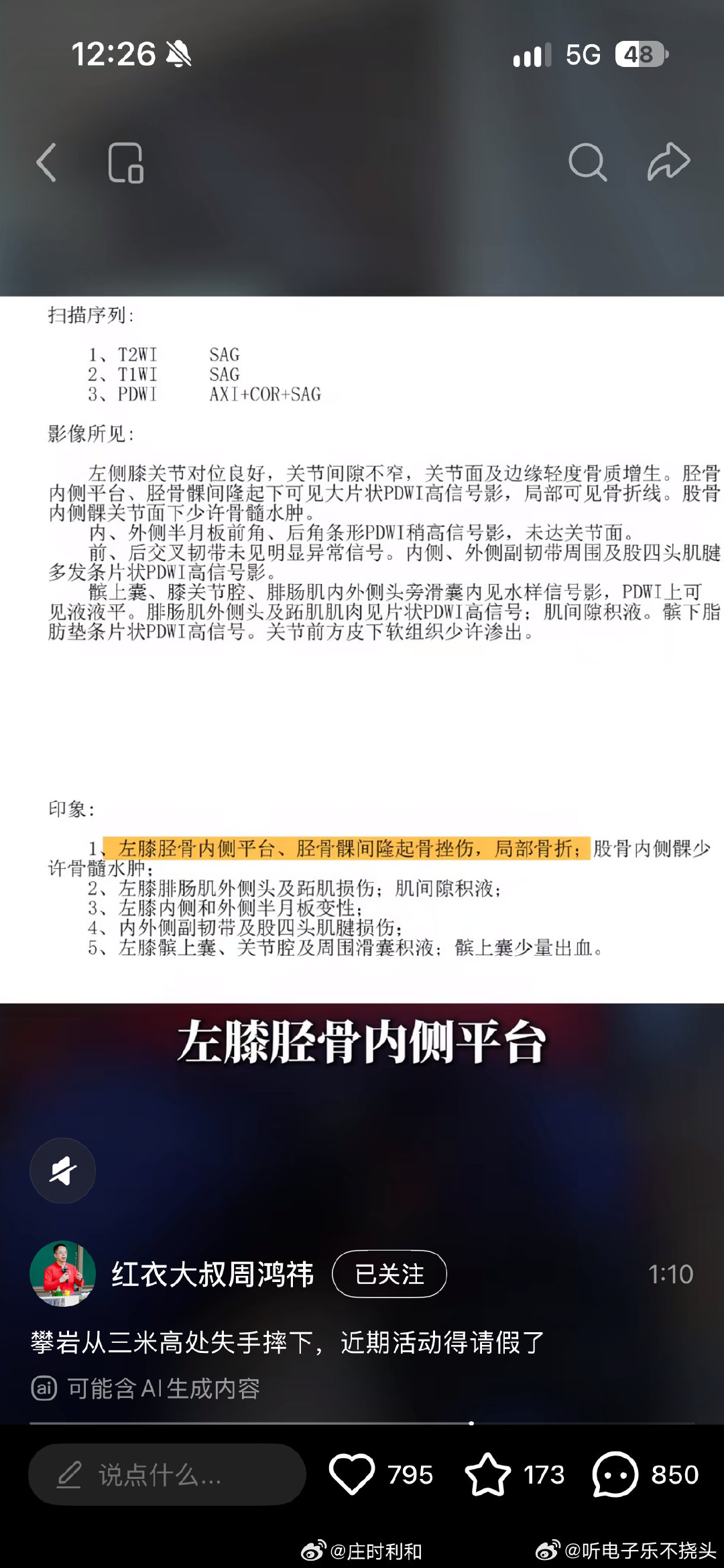 说一个小常识，粉碎性骨折不是很多人想的骨头碎成粉了，一块骨头断成三块或以上就叫粉