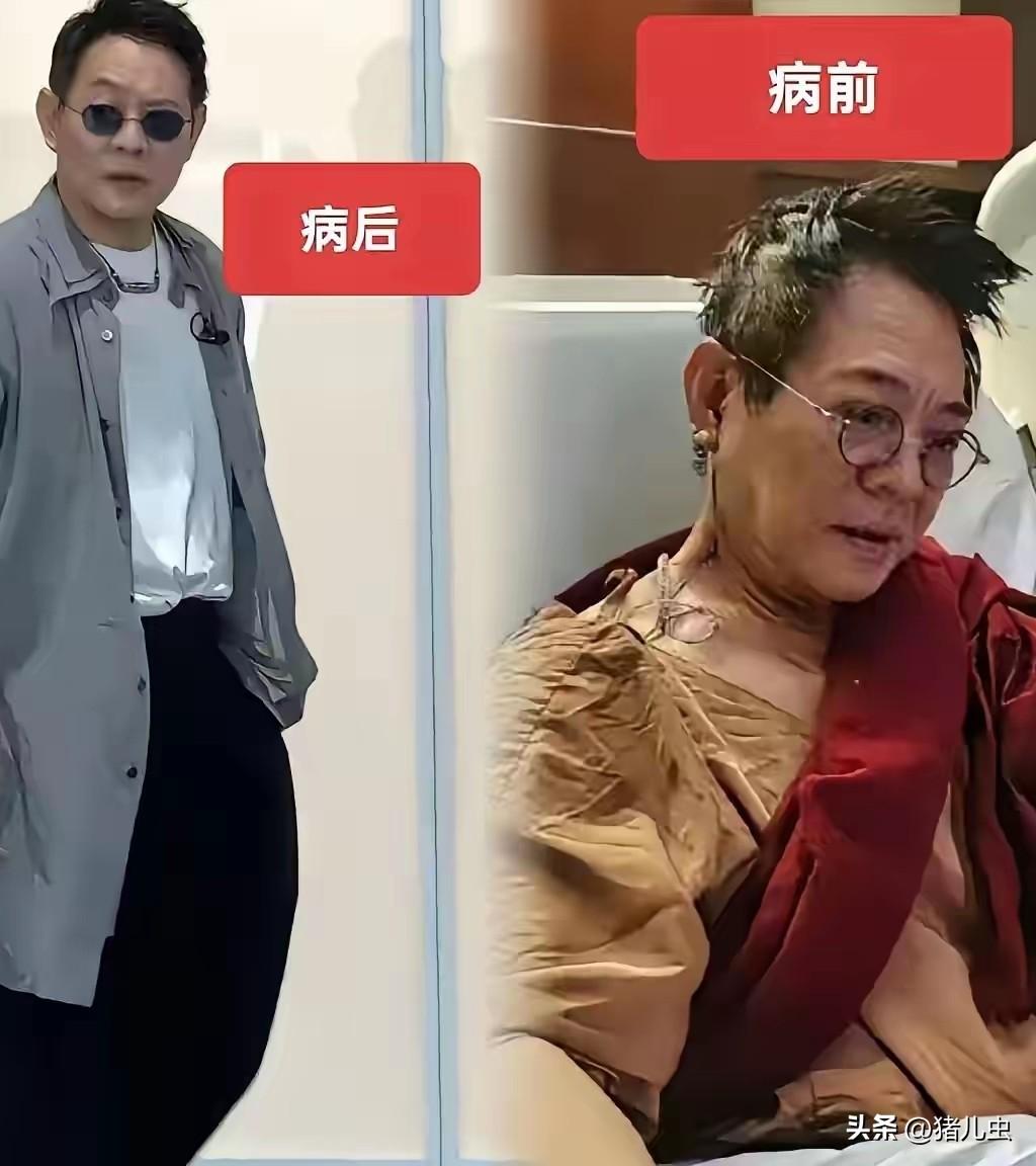 别再死磕中医西医谁更强了
李连杰的经历早给出答案！
说他舍国外先进医疗回国治病，