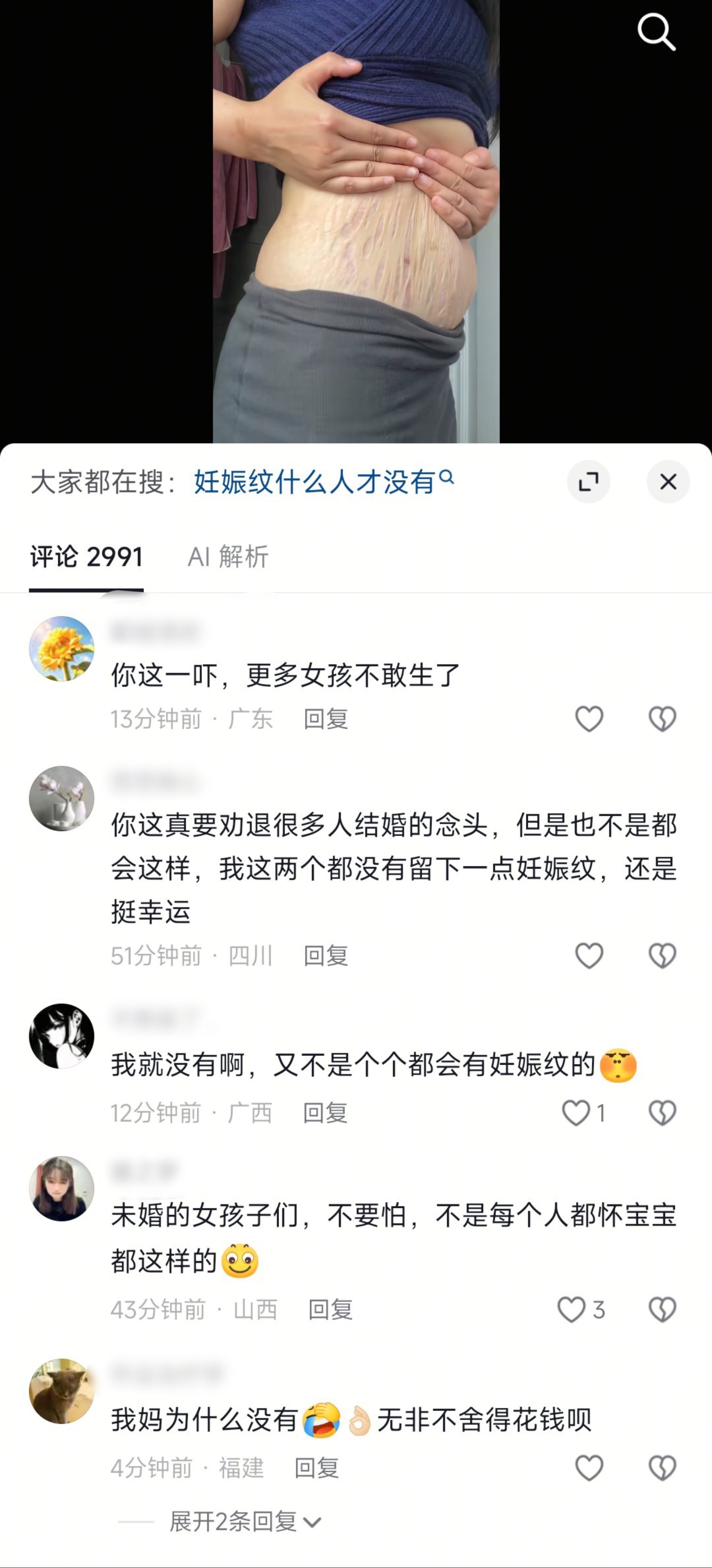 博主只是正常展示生育损伤，评论区你们咋了。。。 