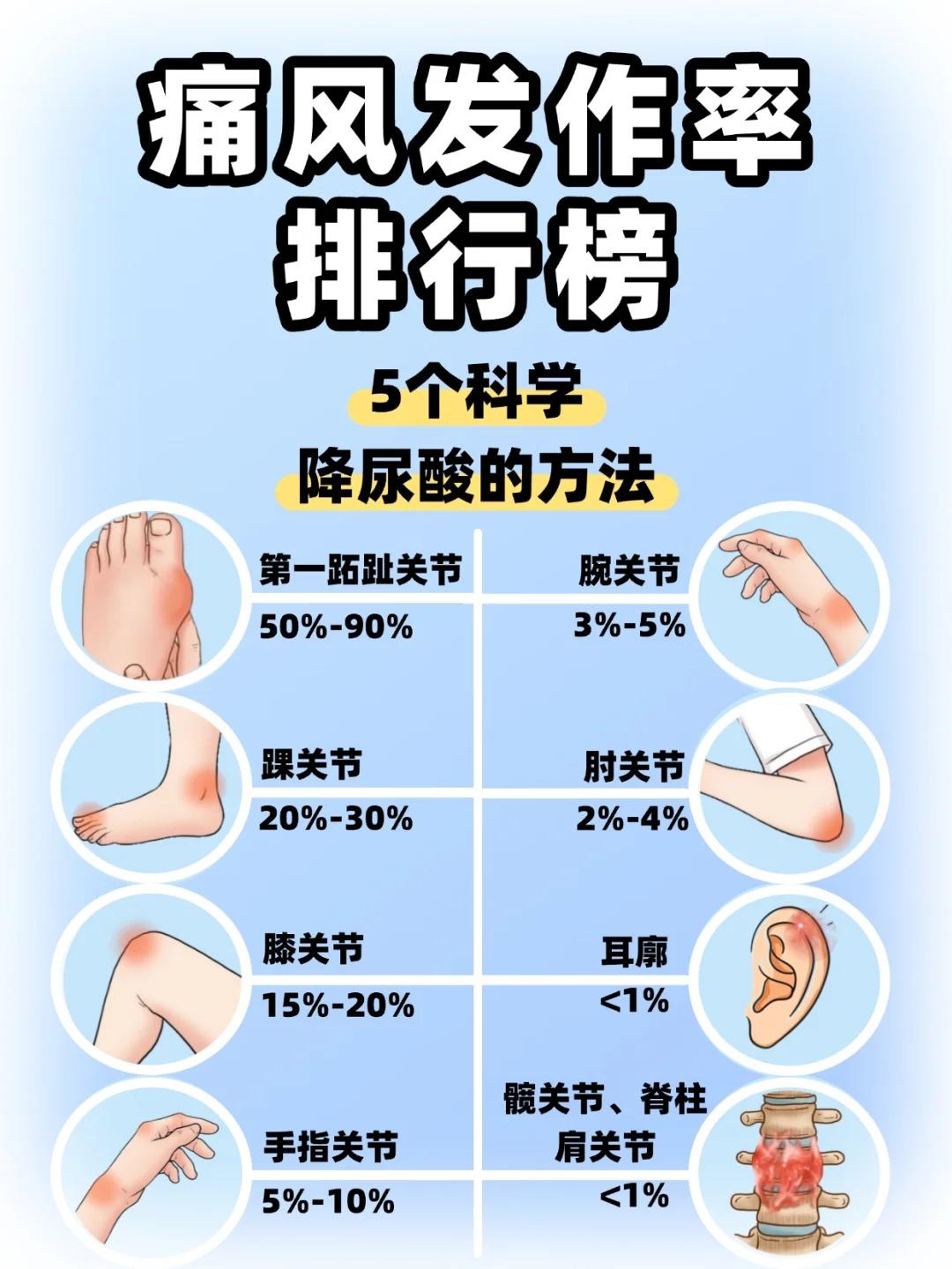 痛风发作部位有啥？痛风发作率排行榜！