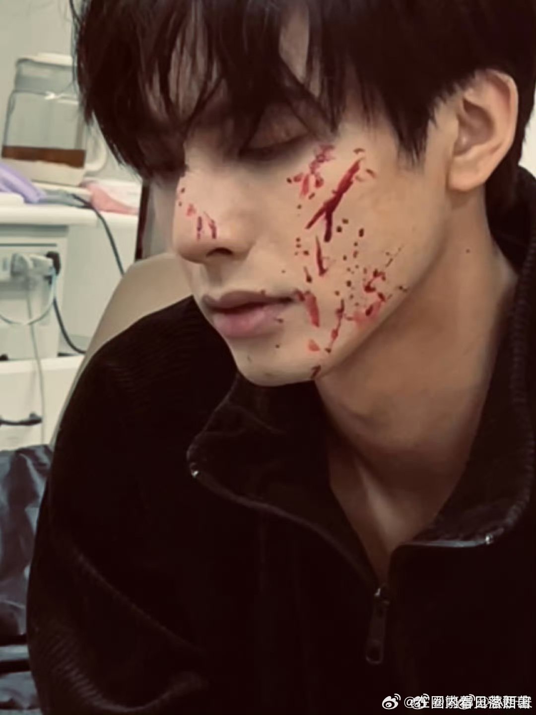 宋威龙受伤妆宋威龙的受伤妆帅的让人无法移开目光呀！真的好心动呀，这个妆造真的让人