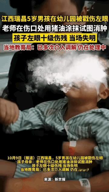一夜醒来，江西瑞昌这对父母的心都碎成渣了！5岁儿子在幼儿园被同学用铅笔戳伤左眼，