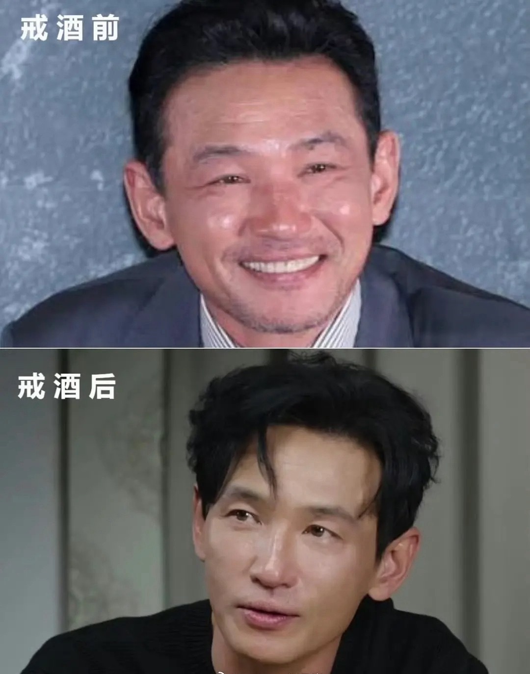 常年喝酒的人真的会变成典型的酒糟脸，整个都是肿的比如内马尔常年泡吧喝酒整个脸肿着