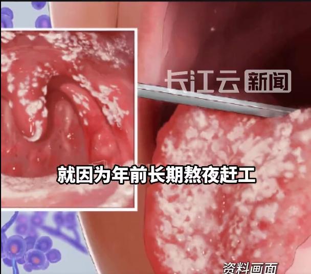 “悲剧还是发生了！”近日，广东深圳，一男子为赶工作进度，晚上连夜加班，拼命奋斗，