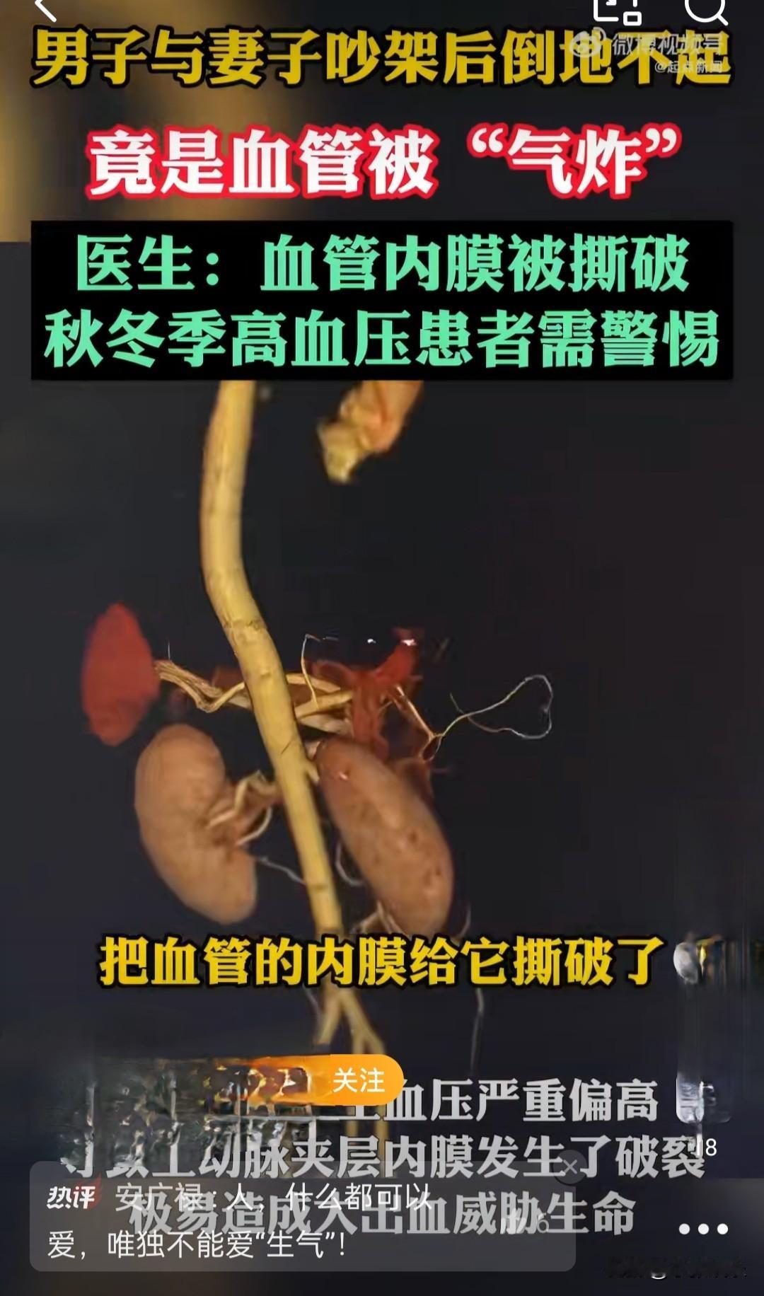[恐惧]过度的情绪激动，竟然会引发高血压?！

来着江苏的张先生跟妻子因为小事吵