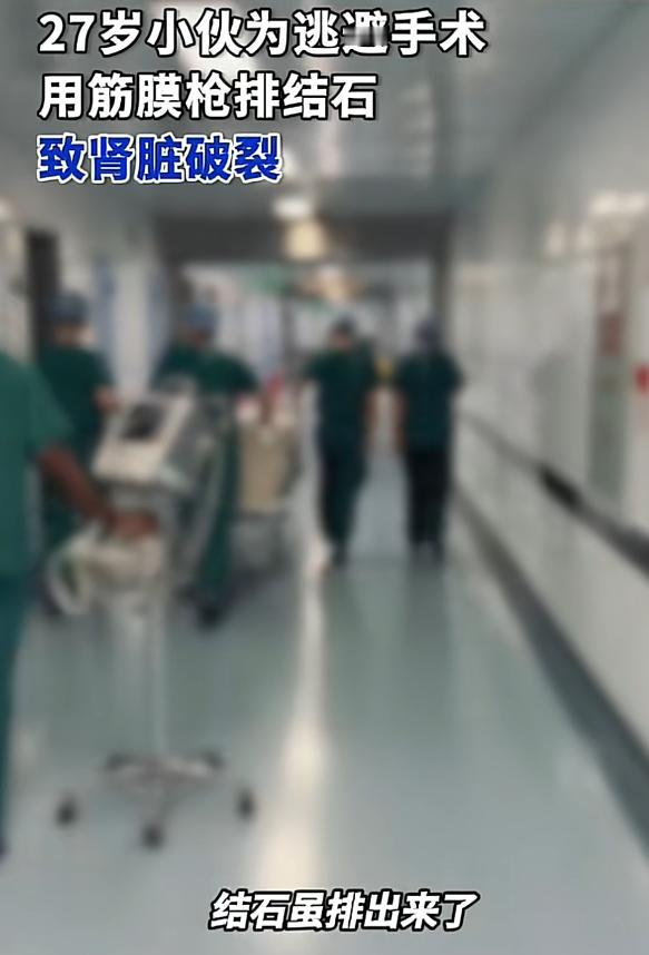 6毫米结石堵住输尿管，27岁男子手术前夜用筋膜枪自行排石：结石出来了，肾脏却破了