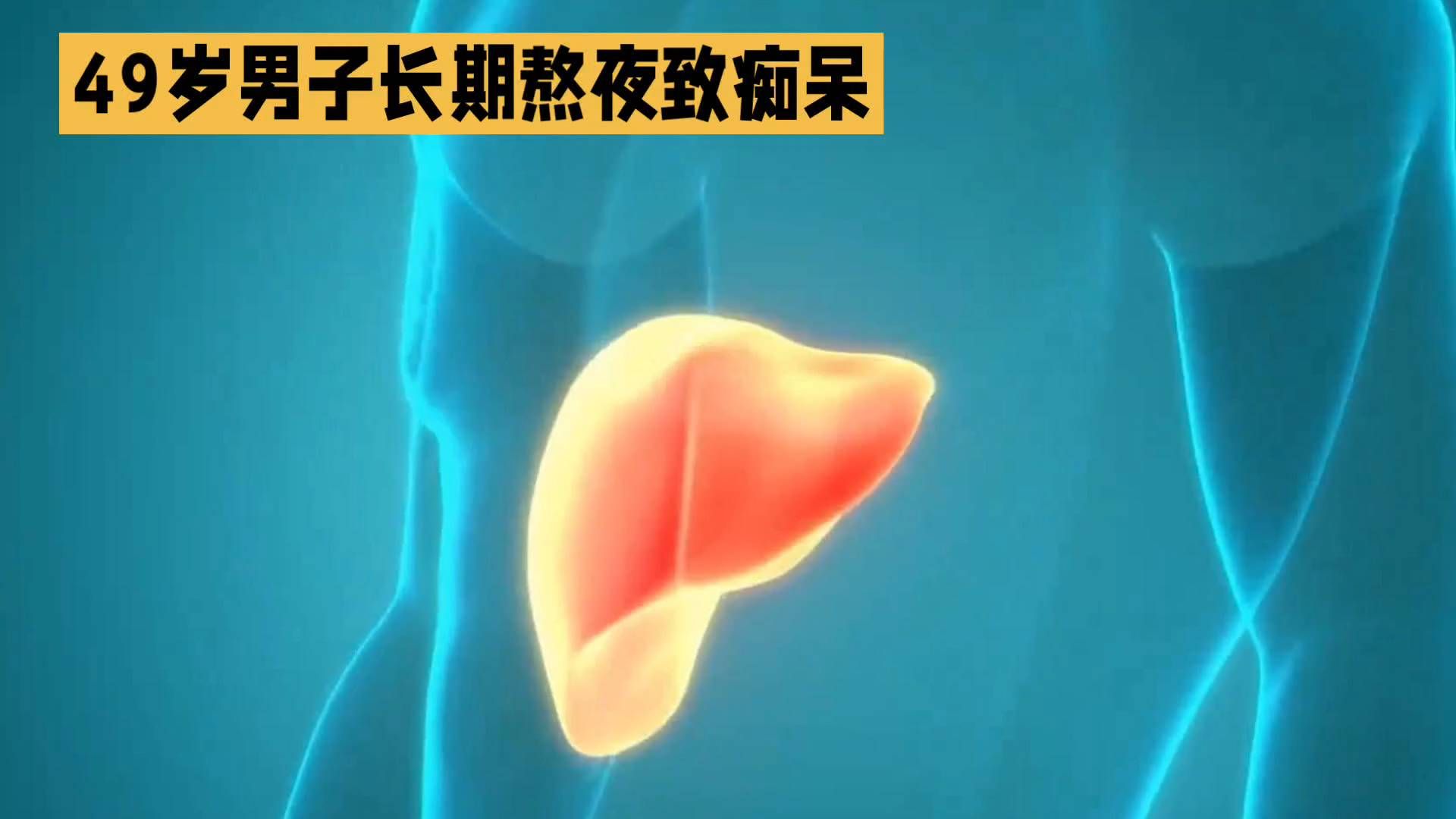 49岁男子长期熬夜致血管性痴呆