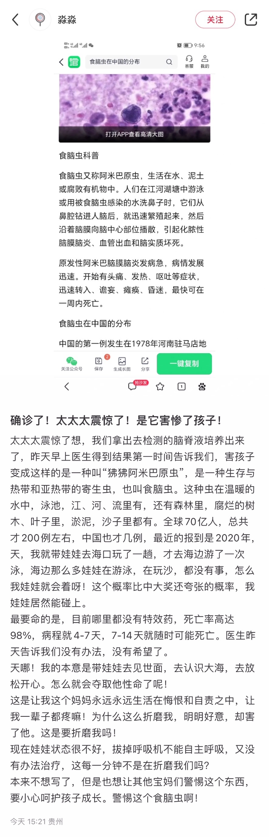 #阿米巴原虫# 健康群里流传着一个孩子去海边游了一次泳，然后感染了“狒狒阿米巴原
