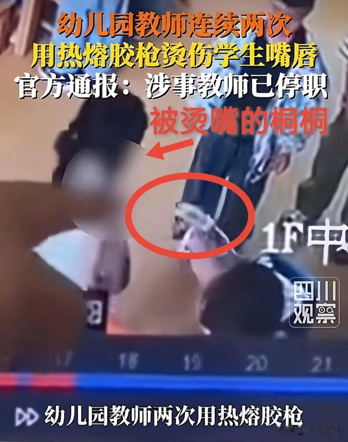 拿热熔胶烫幼童嘴巴的幼师事件看得人心里发堵，做出这种举动，后续三重麻烦一个都躲不