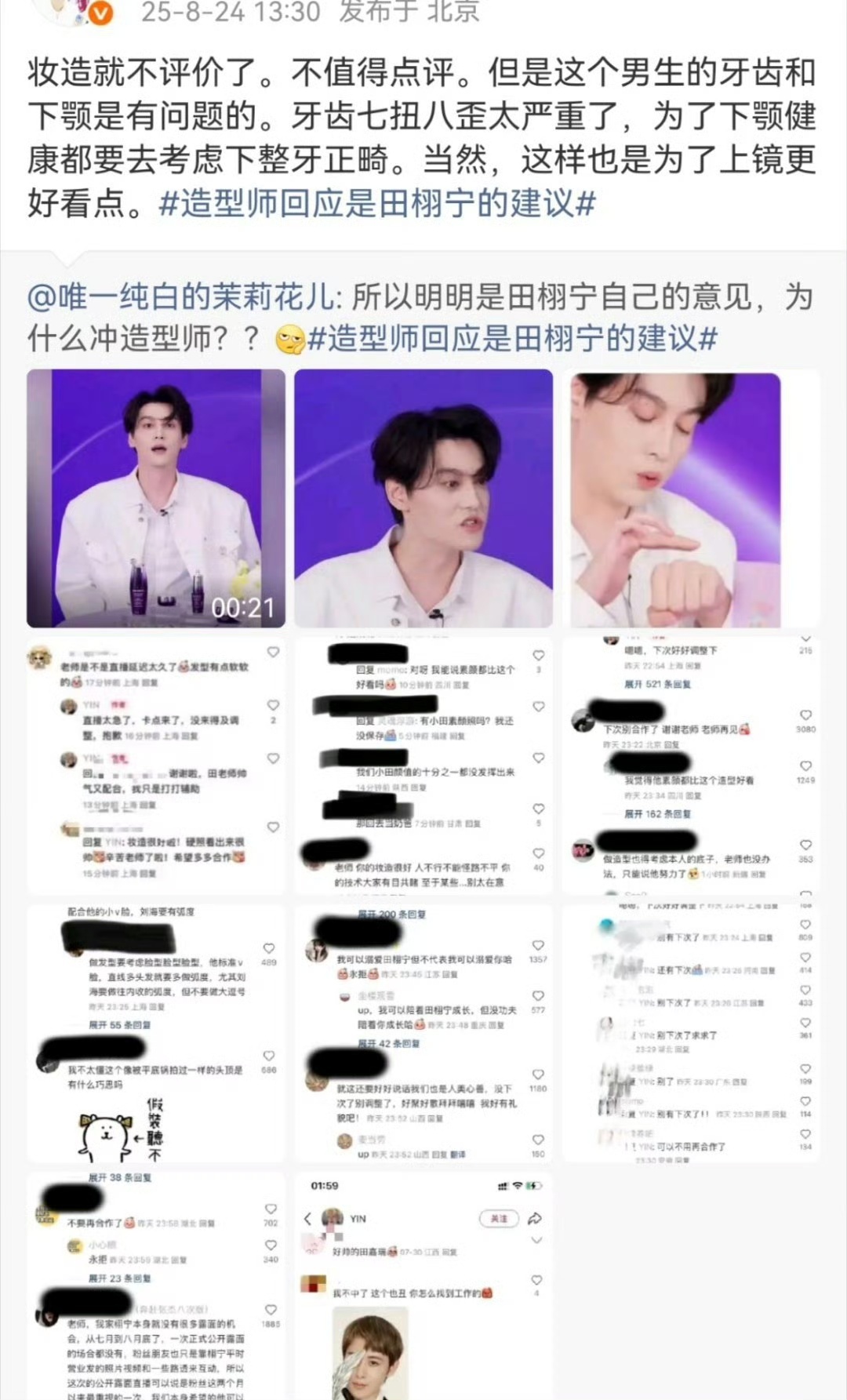 造型师建议田栩宁整牙 ​​​