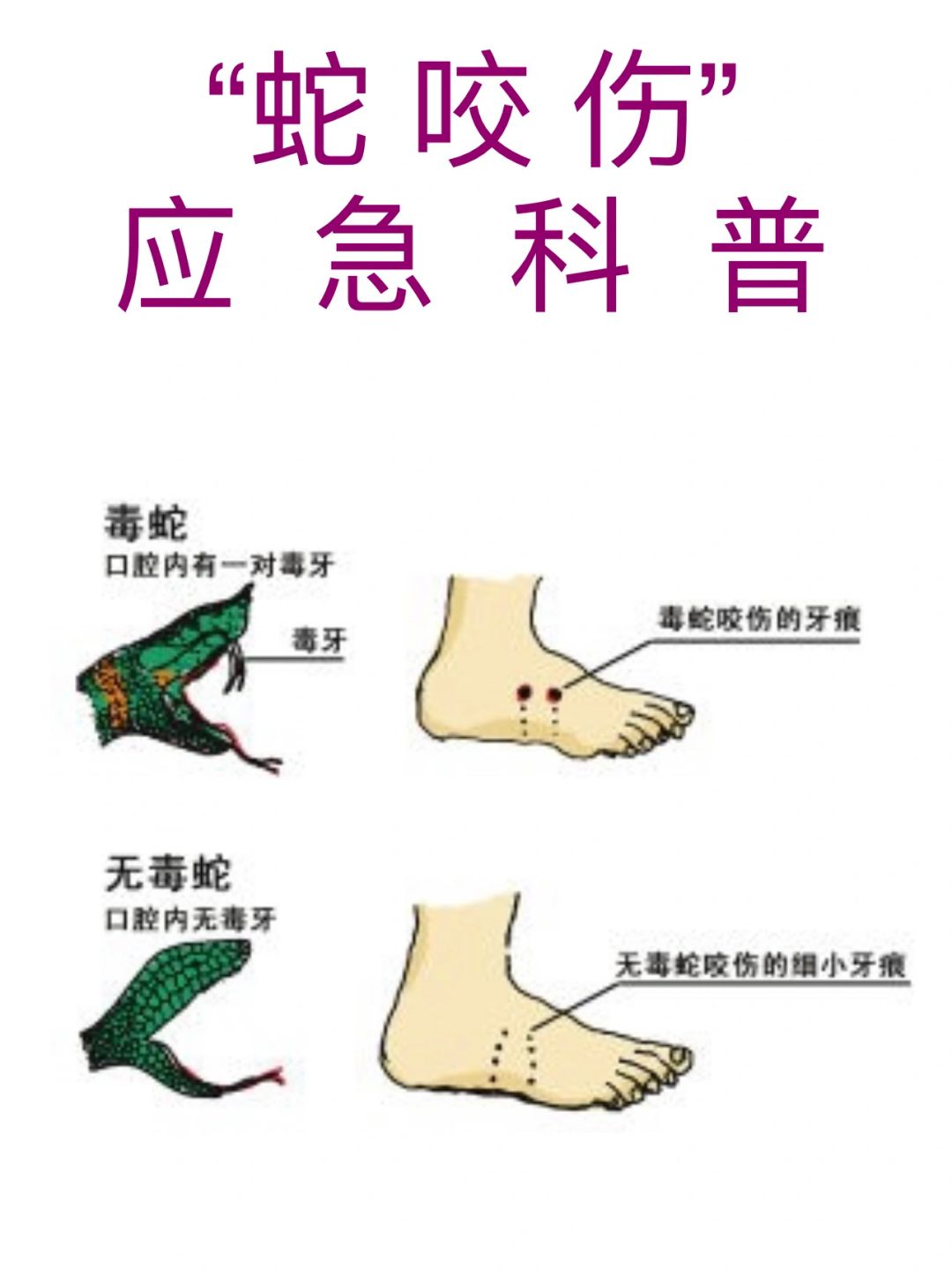 蛇咬伤应急科普