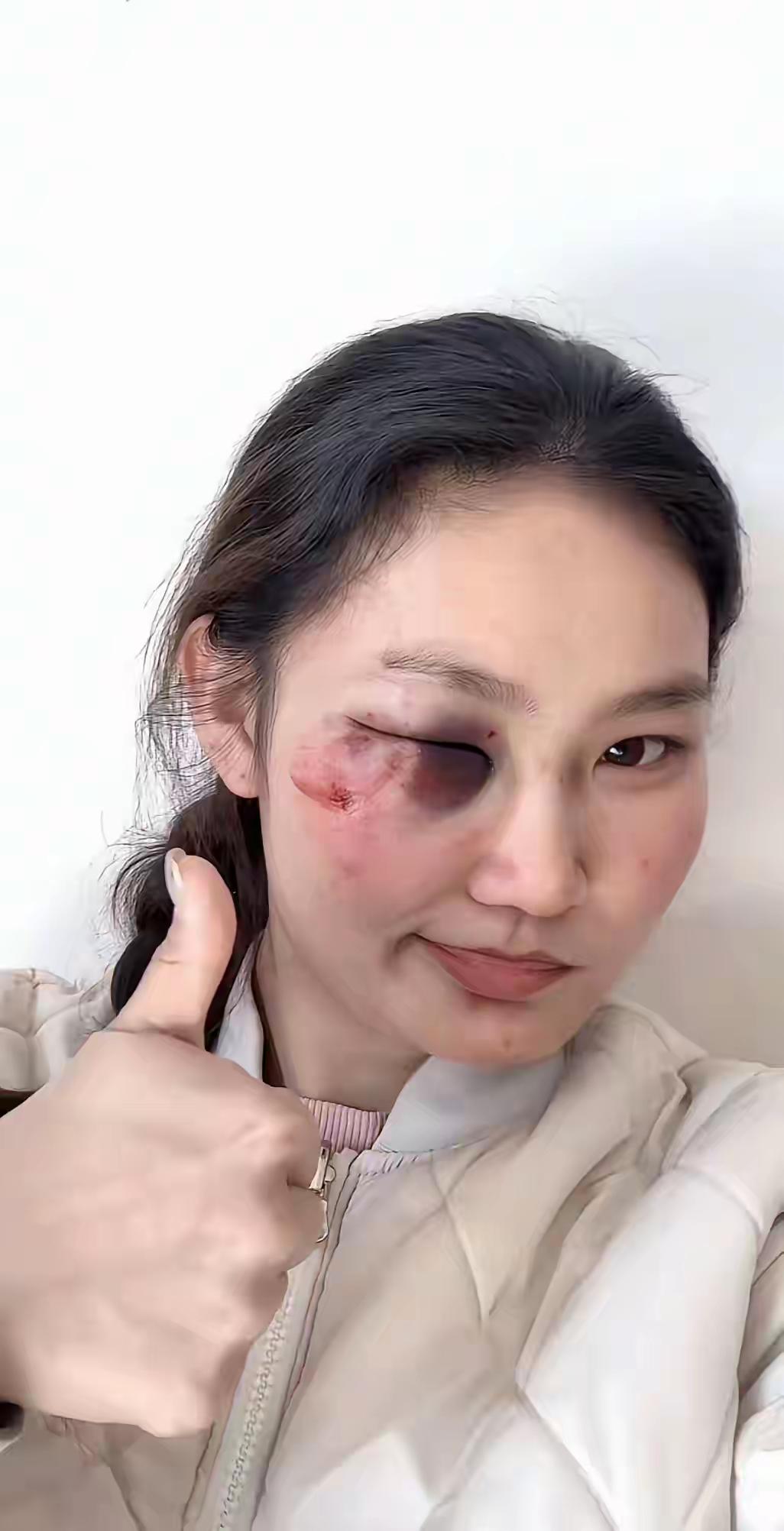 家暴确实是零容忍的，俗话说得好男人的拳头是用来打天下的，而不是不是用来打女人的。