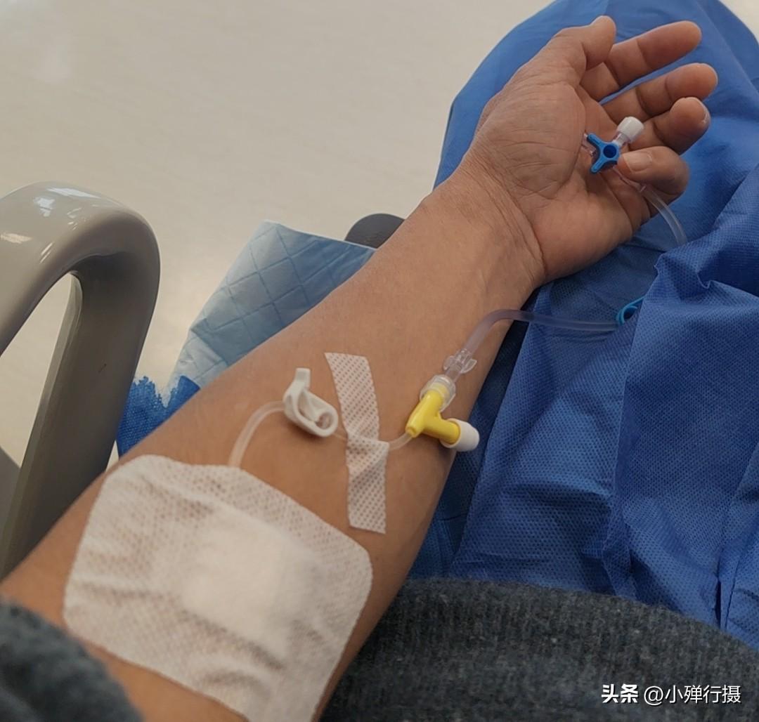 大家做过无痛胃肠镜吗?做无痛胃肠镜有危害吗 我在一星期前就做过。
 今天刷手机，