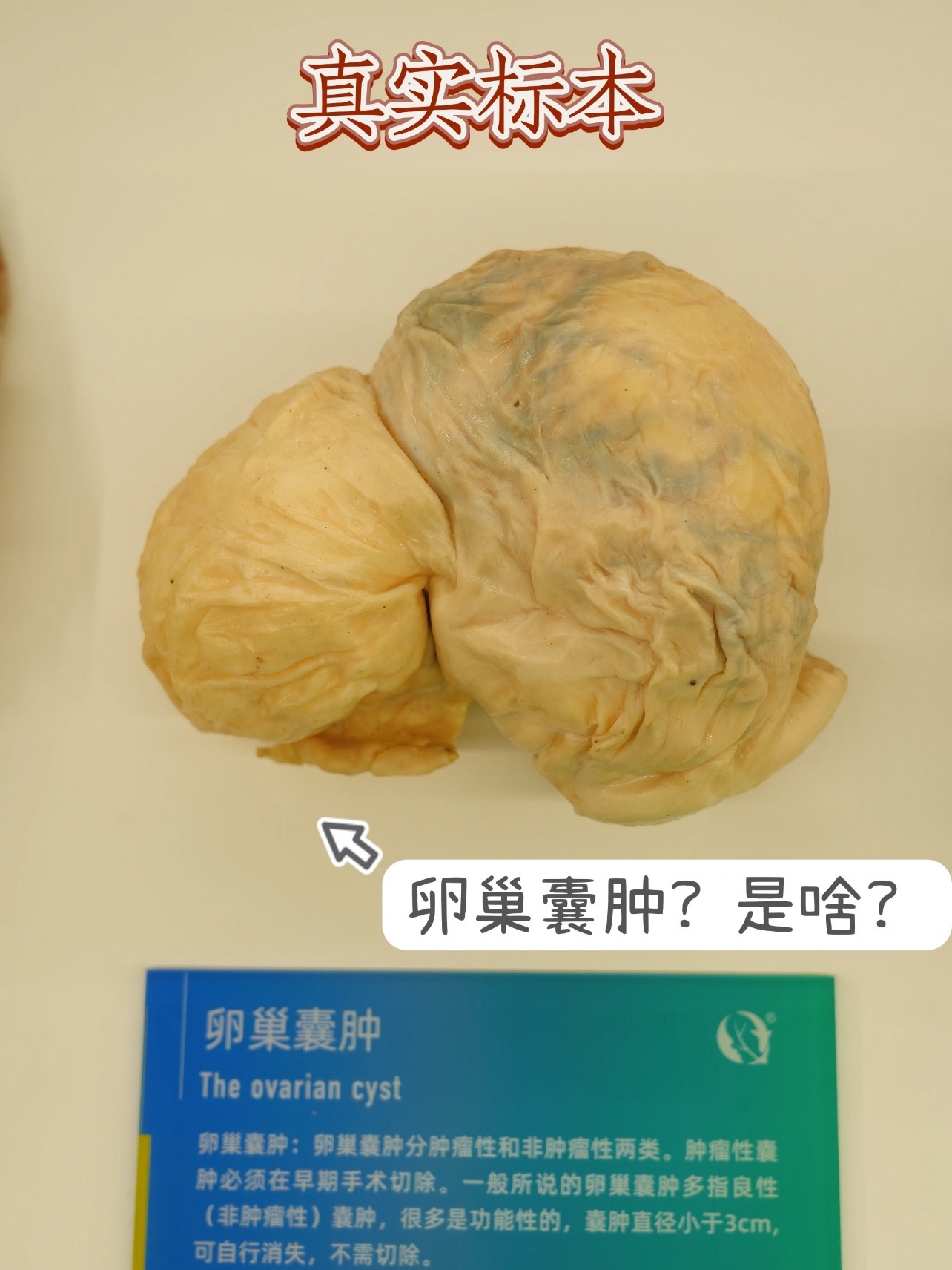 肚子硬硬的苹果型女生要注意，如果你在排空小便后平躺吸气，仍能在腹部摸到位置较深、