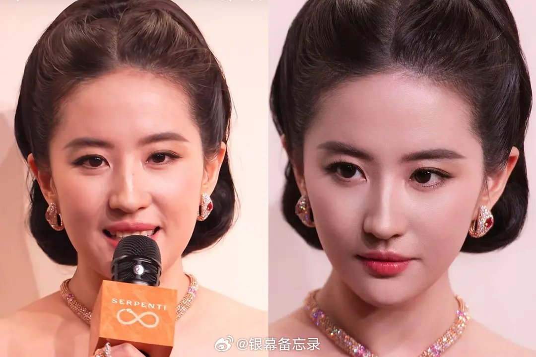 为什么现在的女明星都执着于去掉法令纹？ 