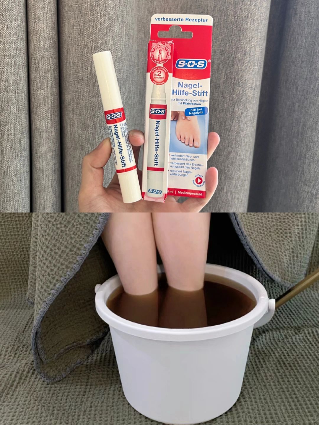 听我的！趾甲有问题千万不要拖！