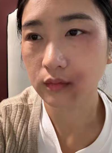 丈夫替亲妈出气，一巴掌扇在怀孕3个月的妻子脸上。这一掌打醒了一个昏沉入睡的女孩，